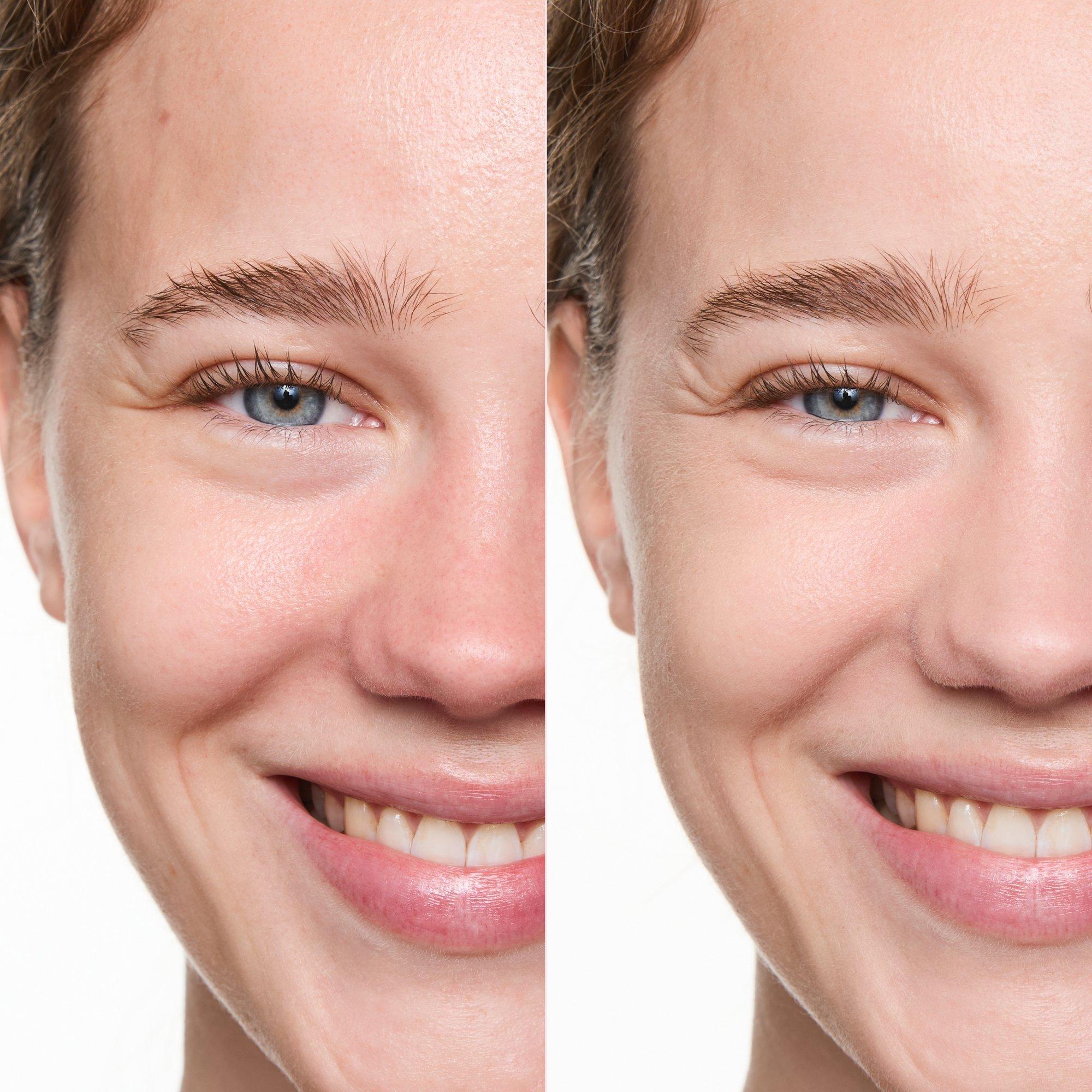 matte BLUR Компактна пудра для матування – Application Before After - Product item 5 of 9