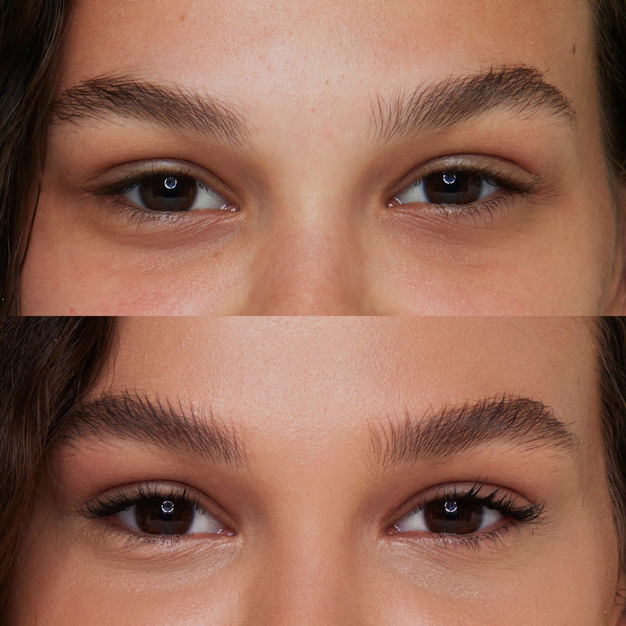 MY PINK THINGS look set – Application Before After - Product item 6 of 12