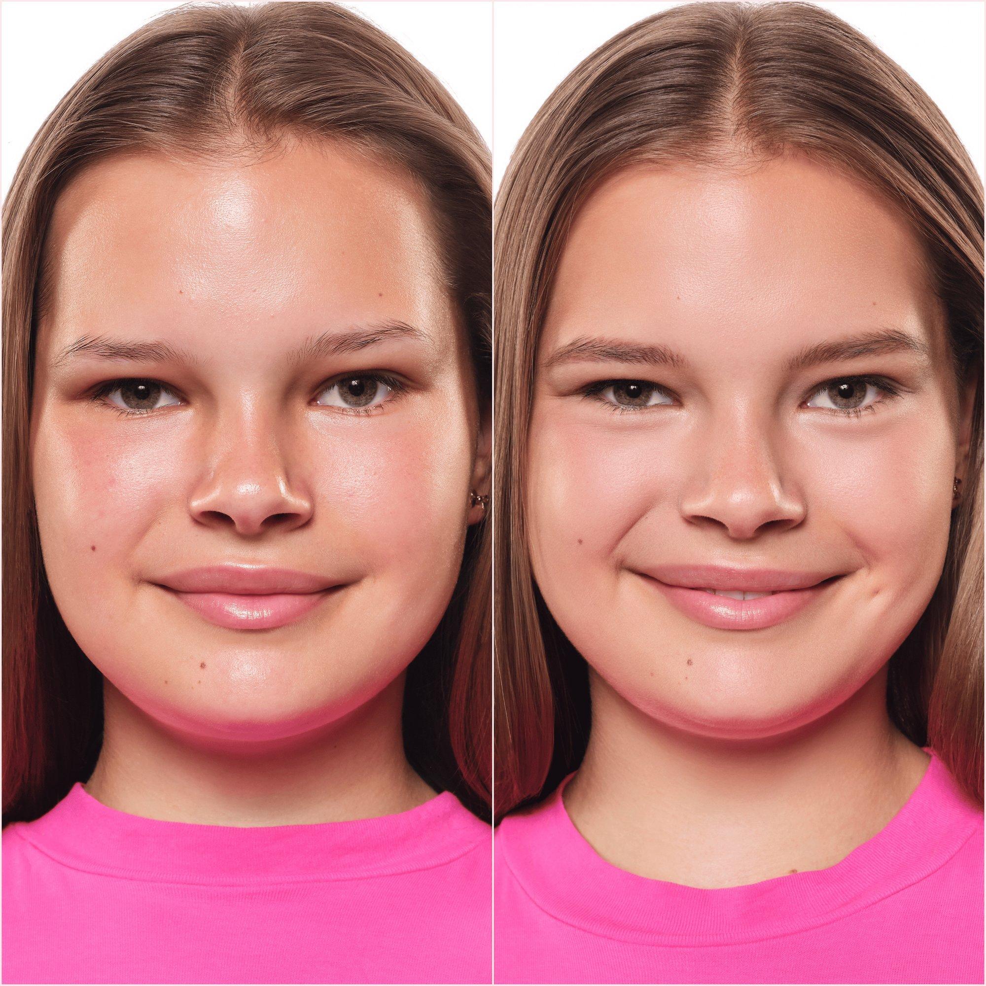 كونسيلر مت كاموفلاج+ – Application Before After - Product item 9 of 12