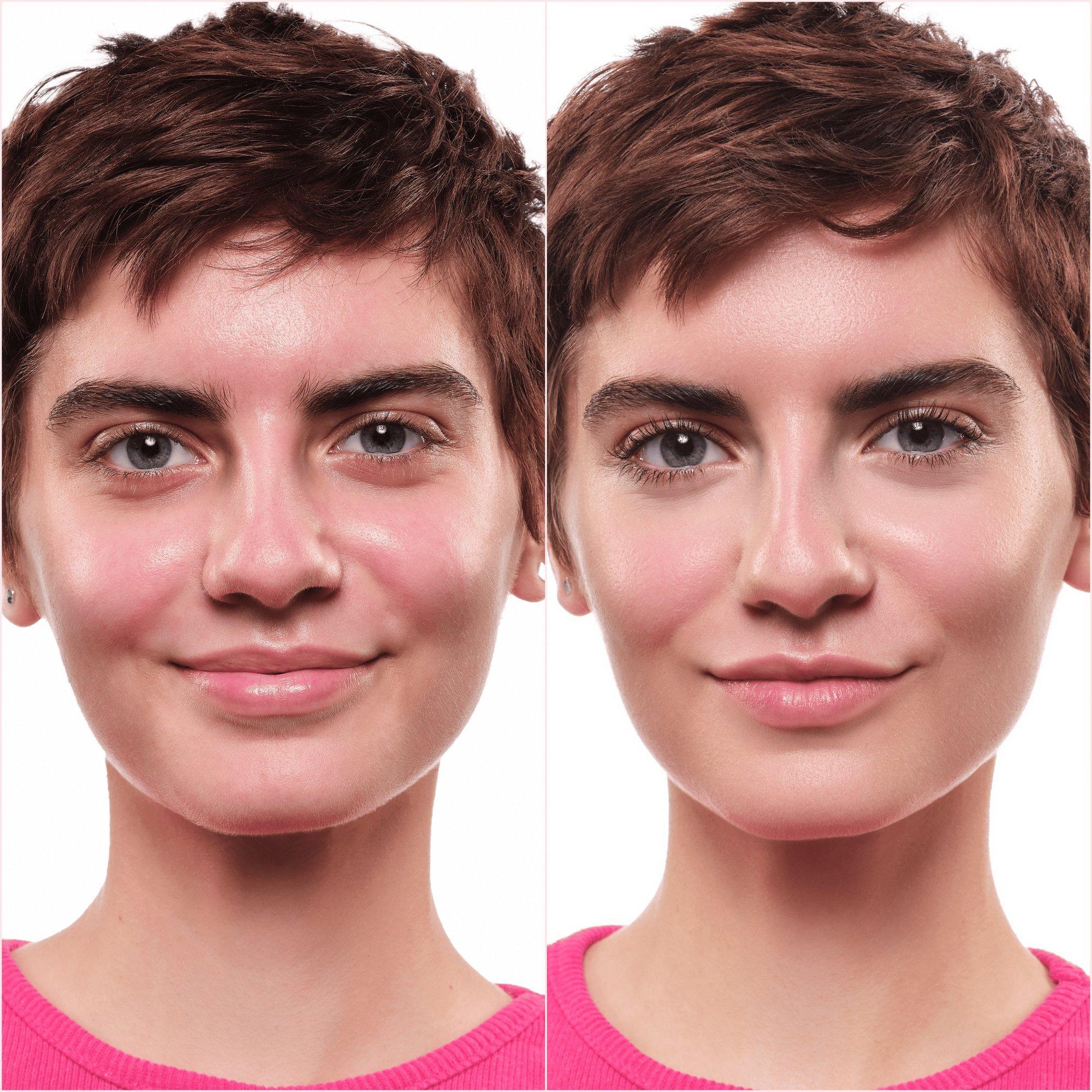 كونسيلر مت كاموفلاج+ – Application Before After - Product item 9 of 12