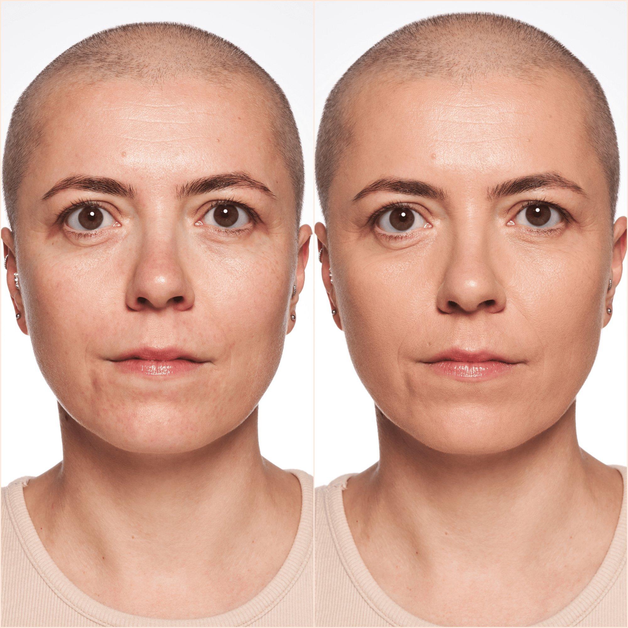 Fond de ten hidratant True Skin
