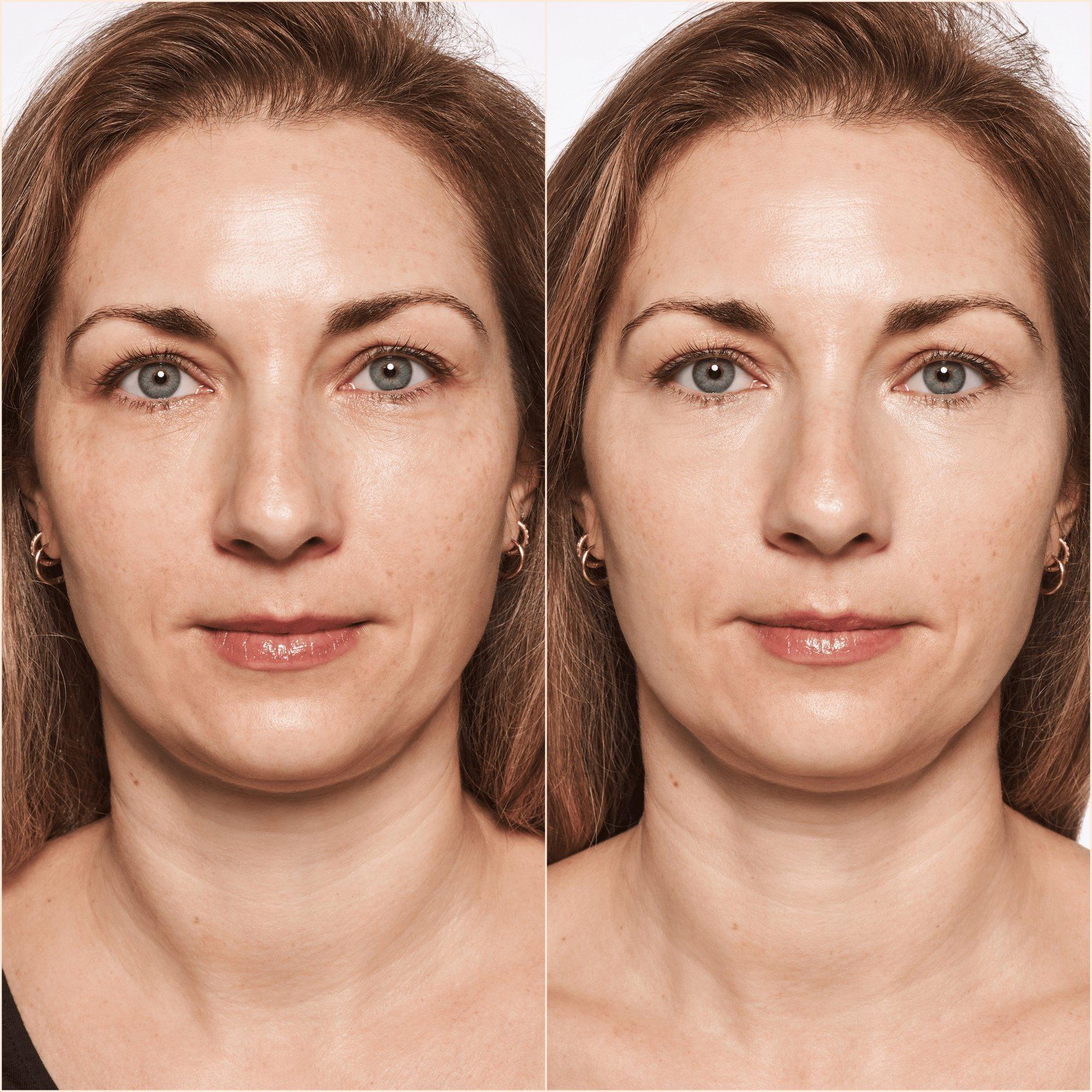Liquid Camouflage High Coverage Concealer