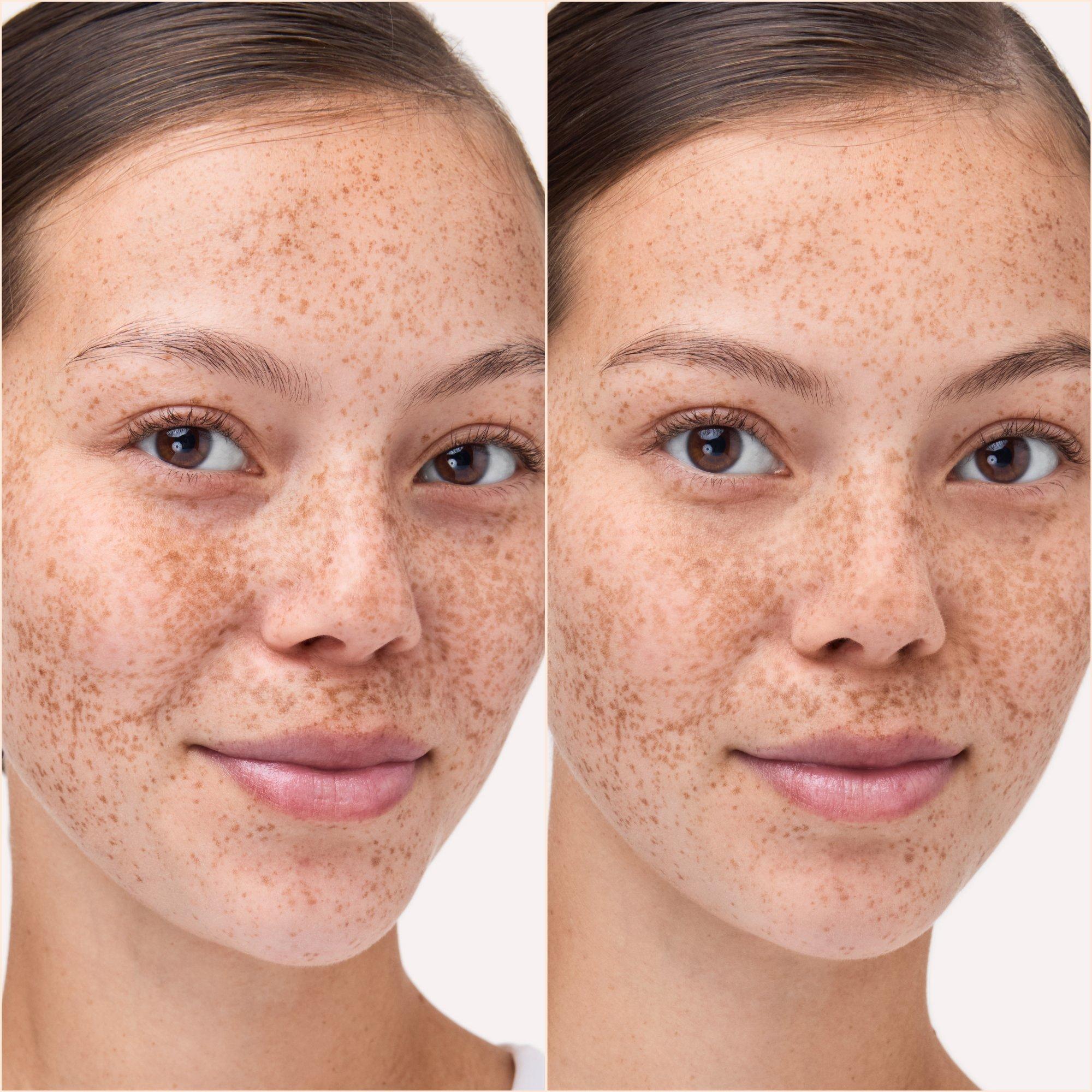 Soft Blur Матова фіксуюча пудра – Application Before After - Product item 5 of 9