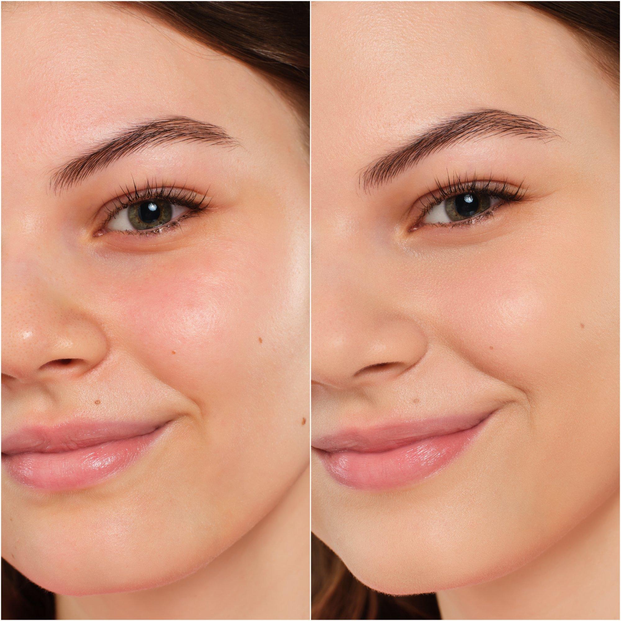 Phấn tươi NATURAL MATTE MOUSSE FOUNDATION