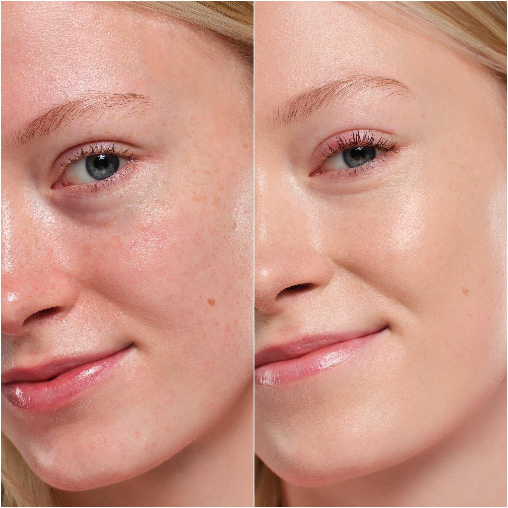 أنا أحب كريم أساس البشرة الخالية من العيوب