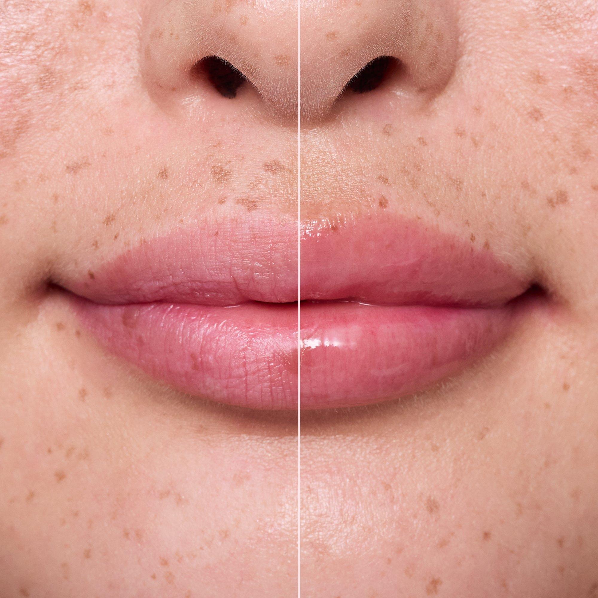 Lūpų priežiūros priemonė JUICY SERUM hydrating lip treatment – Application Before After - Product item 9 of 10
