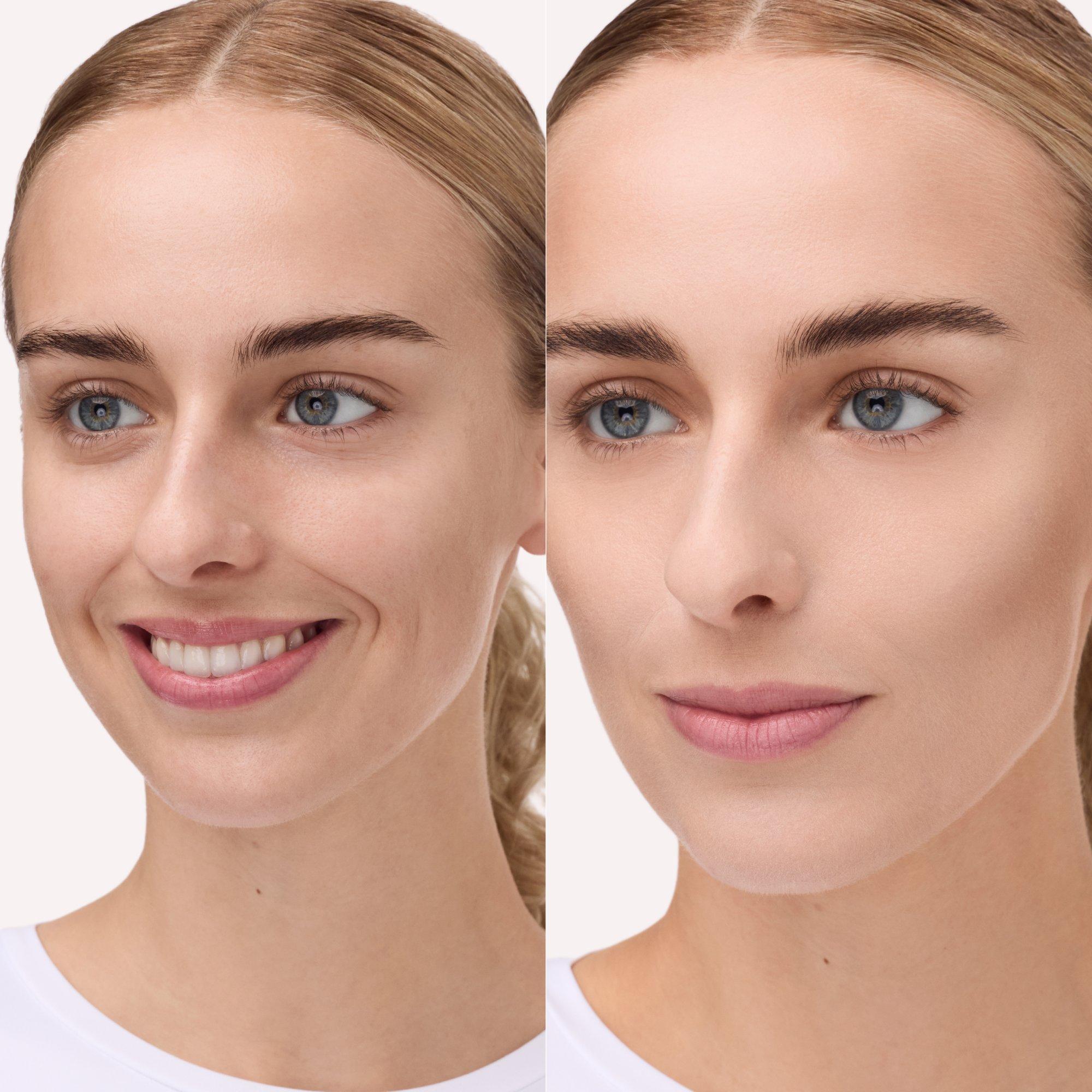 Allround Concealer