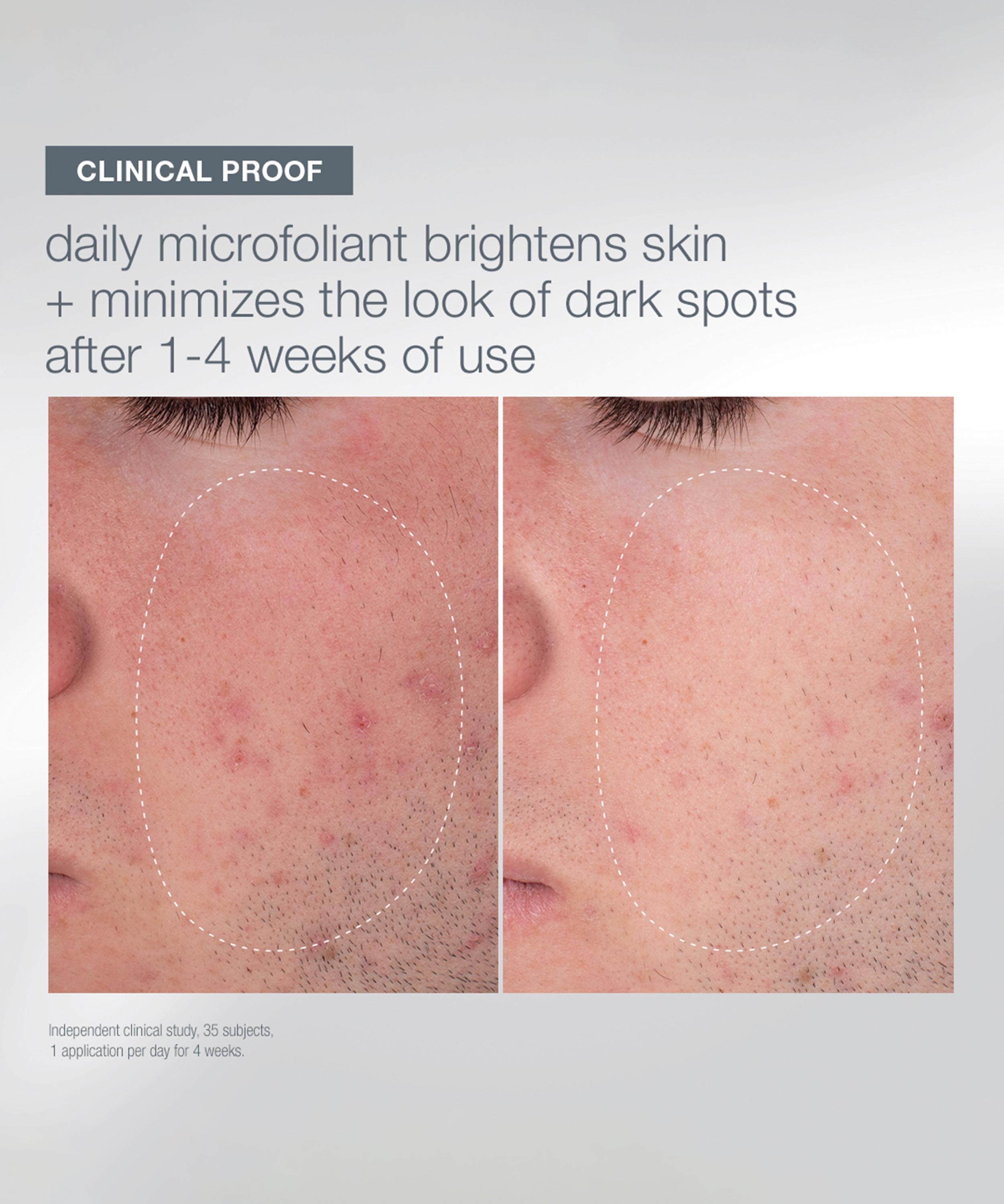 Dermalogica - Daily Microfoliant 13g image number 4