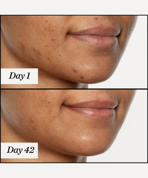 Sunday Riley - U.F.O. Ultra-Clarifying Acne Treatment Face Oil 35ml image number 4