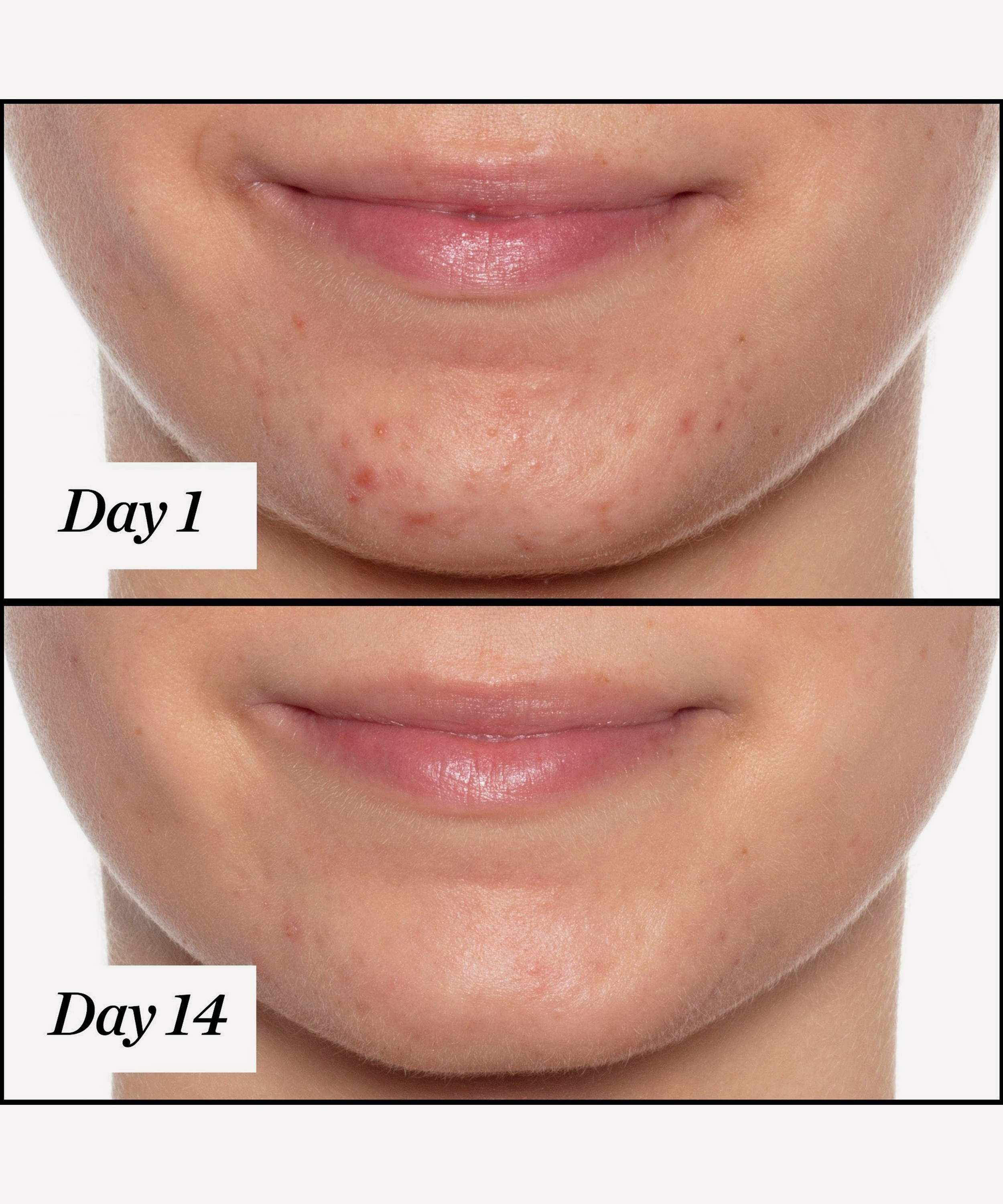 Sunday Riley - U.F.O. Ultra-Clarifying Acne Treatment Face Oil 35ml image number 5