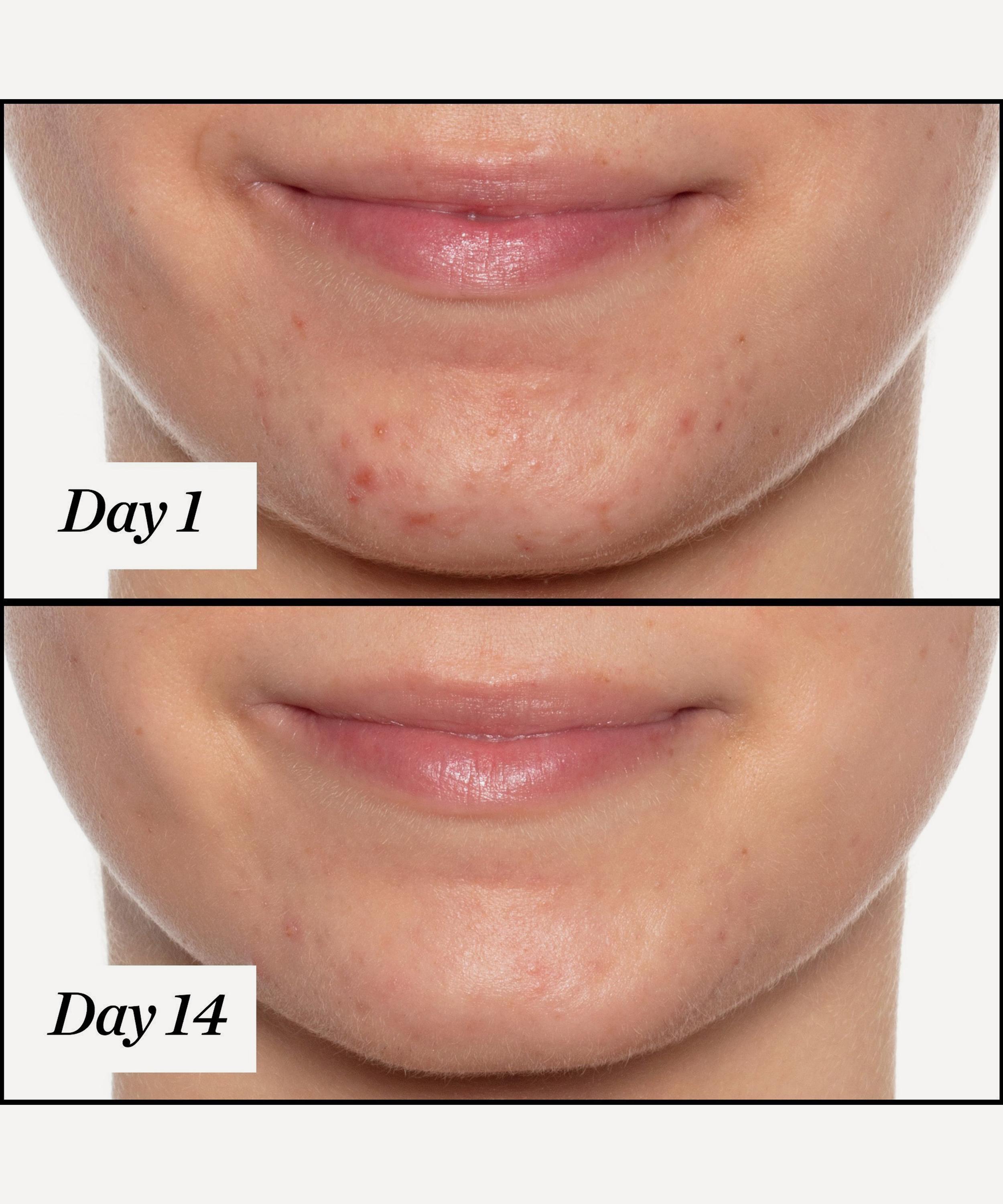 Ultra-Clarifying Facial Day Oil