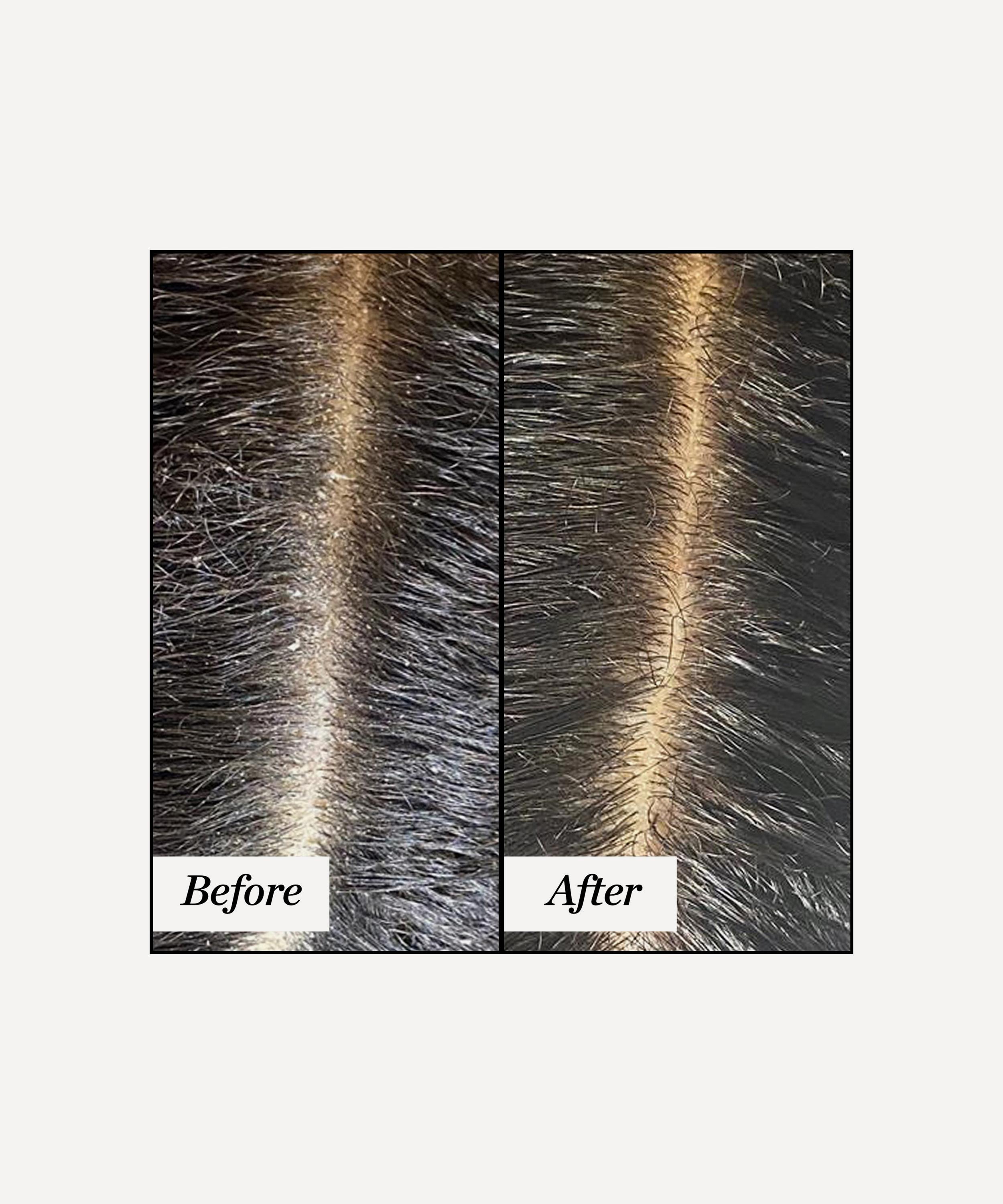 Sunday Riley - Clean Rinse Clarifying Scalp Serum 120ml image number 3