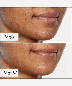 Sunday Riley - U.F.O. Ultra-Clarifying Acne Treatment Face Oil 15ml image number 4