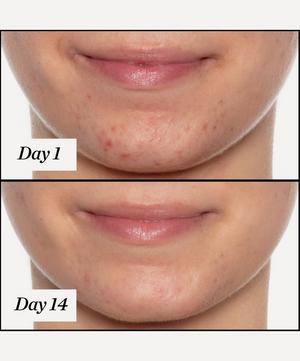 Sunday Riley - U.F.O. Ultra-Clarifying Acne Treatment Face Oil 15ml image number 5