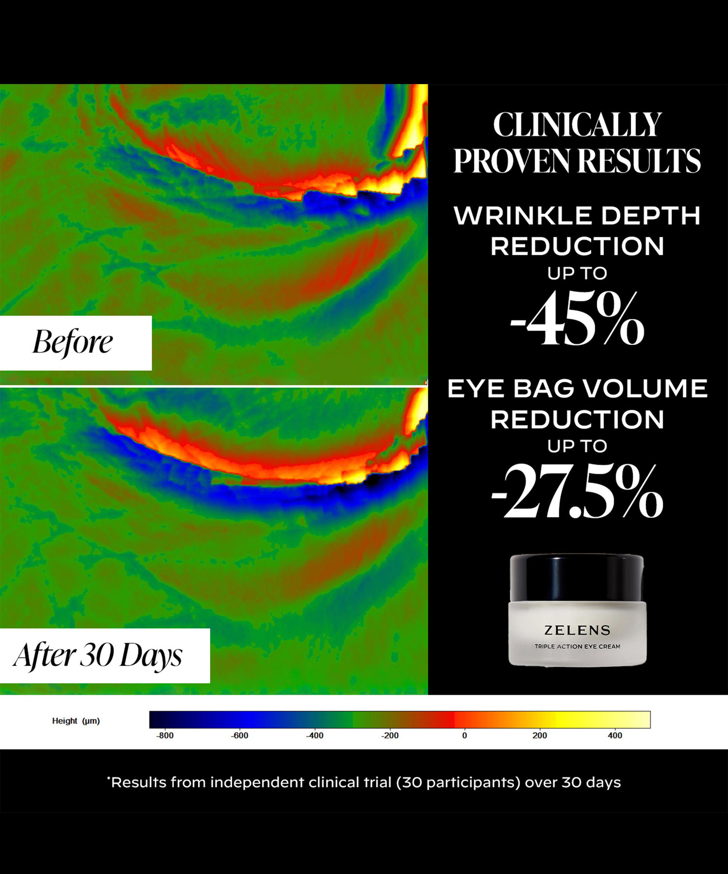 Zelens - Triple Action Eye Cream 15ml image number 5