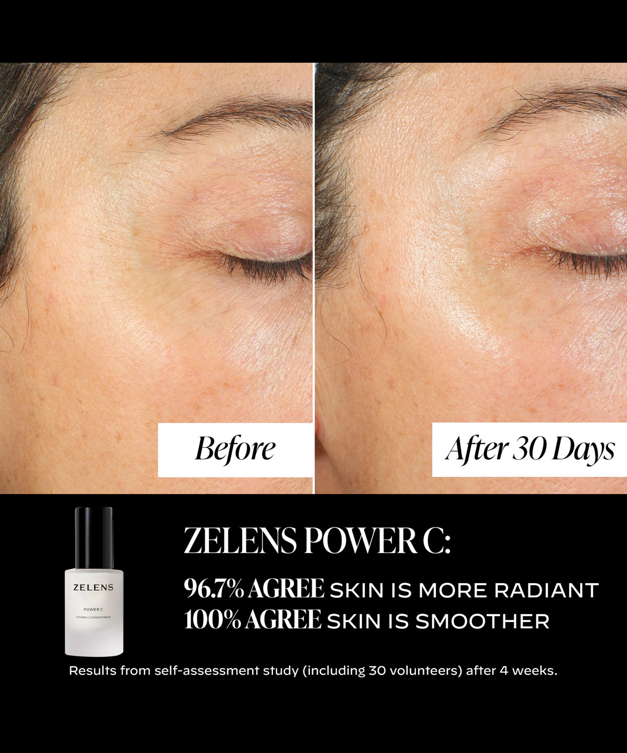 Zelens - Power C Collagen-Boosting & Brightening Concentrate 30ml image number 6