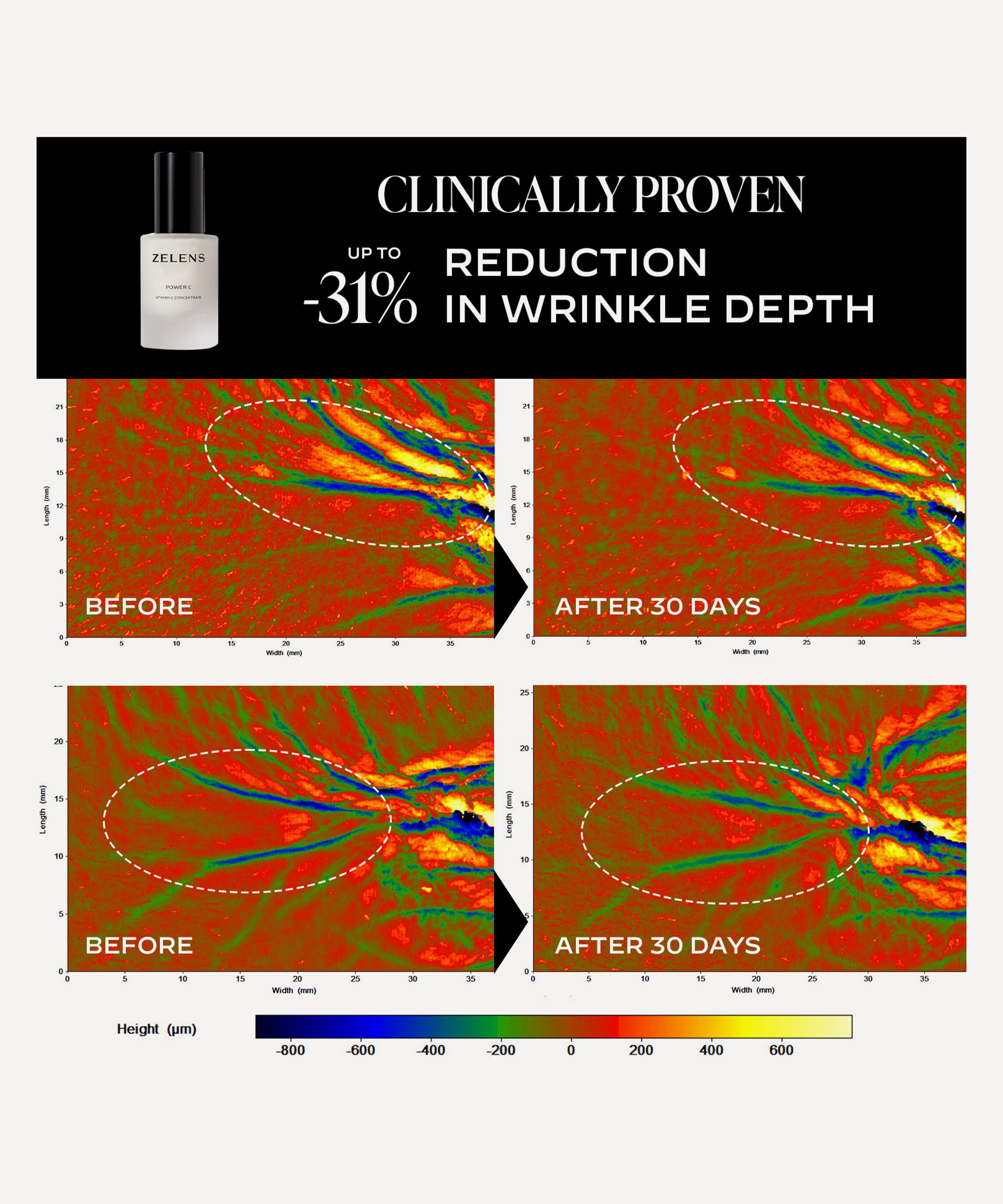Zelens - Power C Collagen-Boosting & Brightening Concentrate 30ml image number 7