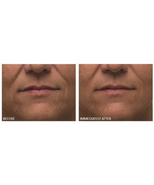Dr. Dennis Gross Skincare - Alpha Beta Ultra Gentle Daily Peel 30 Pack image number 3