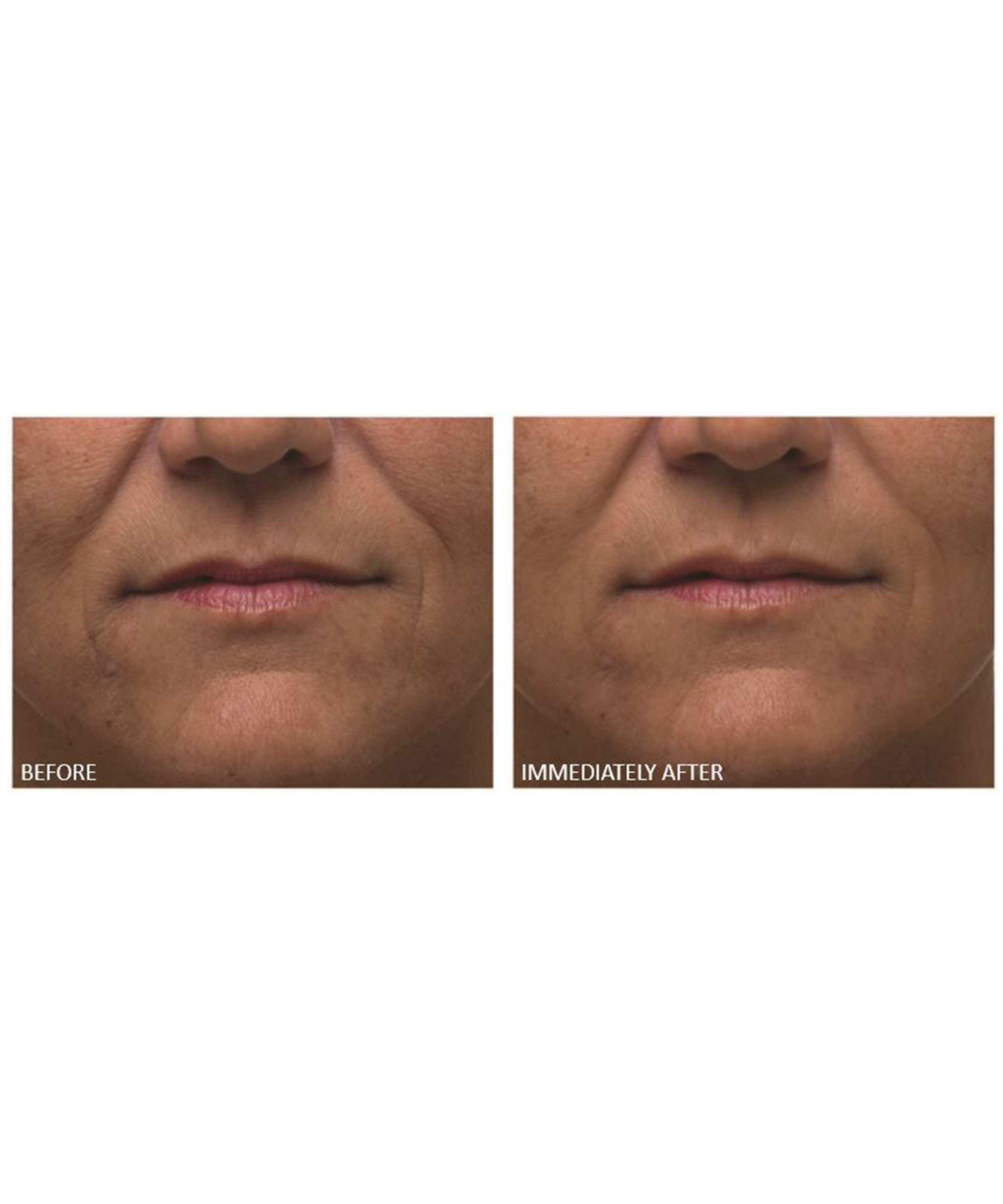 Dr. Dennis Gross Skincare - Alpha Beta Ultra Gentle Daily Peel 30 Pack image number 3
