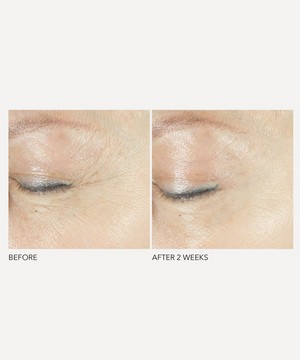 Dr. Dennis Gross Skincare - Advanced Retinol + Ferulic Triple Correction Eye Serum 15ml image number 2