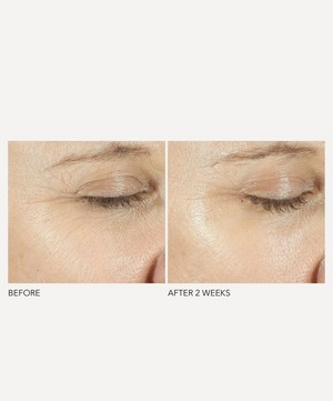 Dr. Dennis Gross Skincare - Advanced Retinol + Ferulic Triple Correction Eye Serum 15ml image number 3
