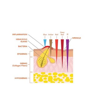 Dr. Dennis Gross Skincare - DRx SpectraLite FaceWare Pro image number 2