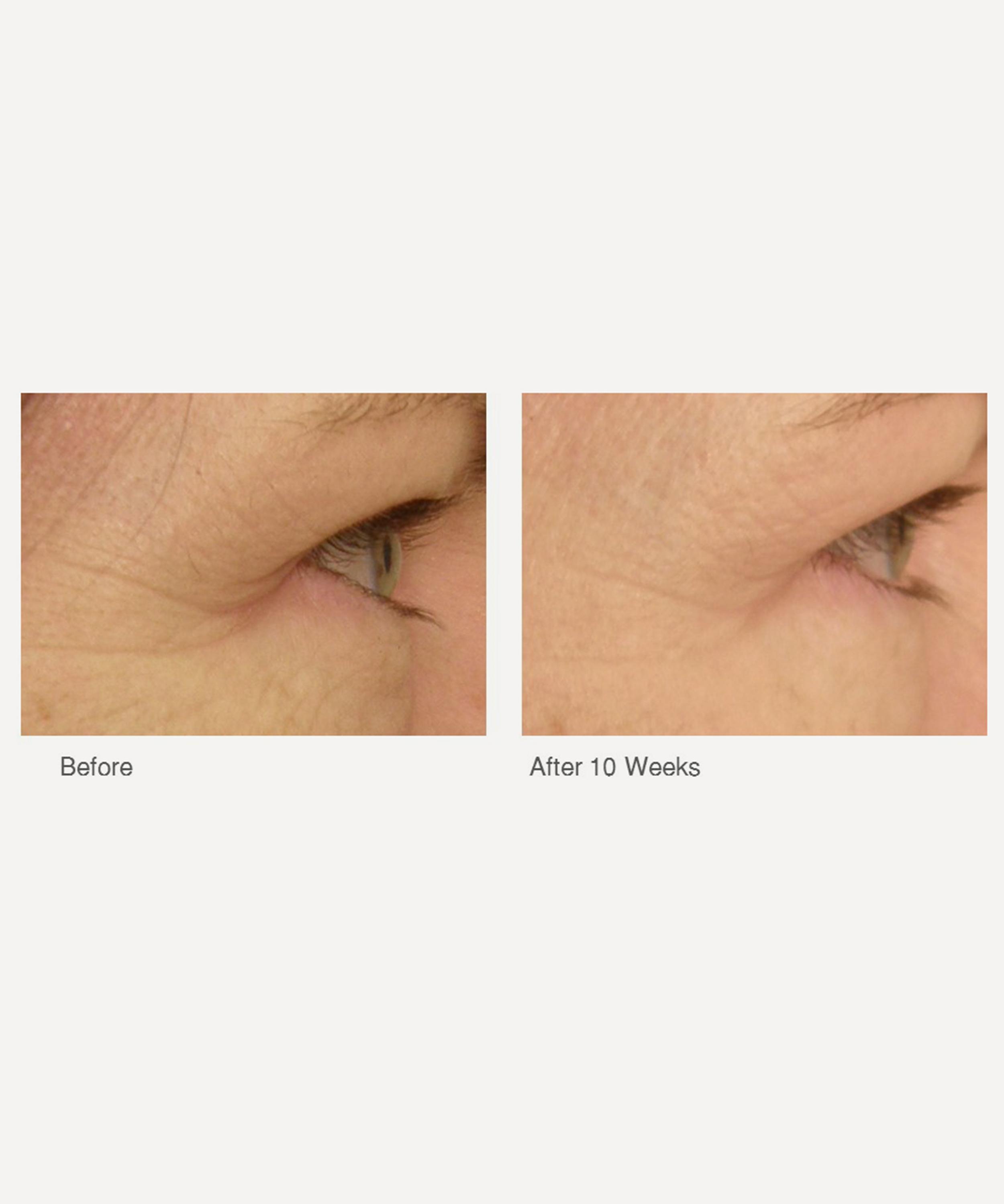 Dr. Dennis Gross Skincare - DRx SpectraLite EyeCare Pro image number 1