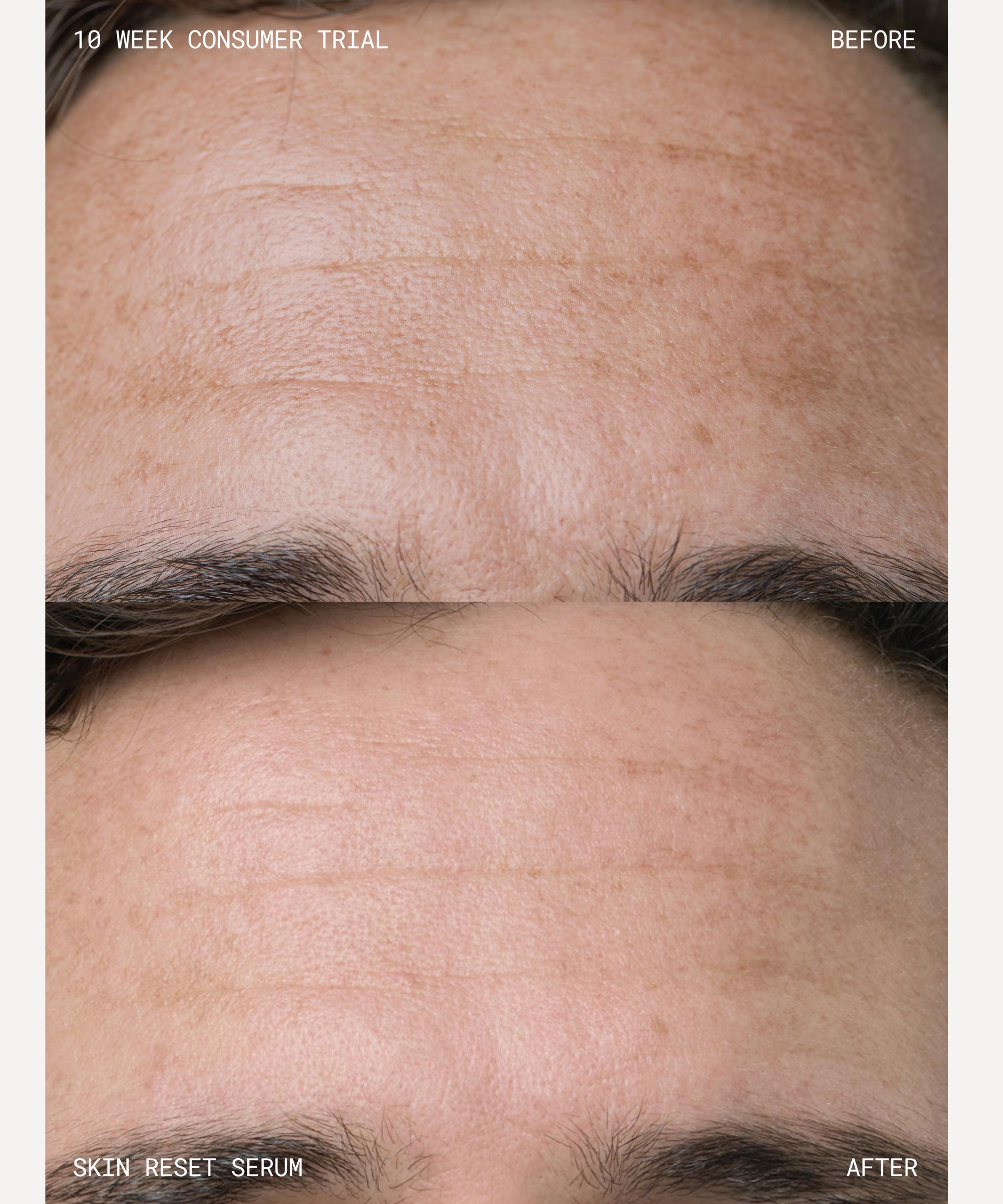 Emma Lewisham - Skin Reset Face Serum 30ml image number 6