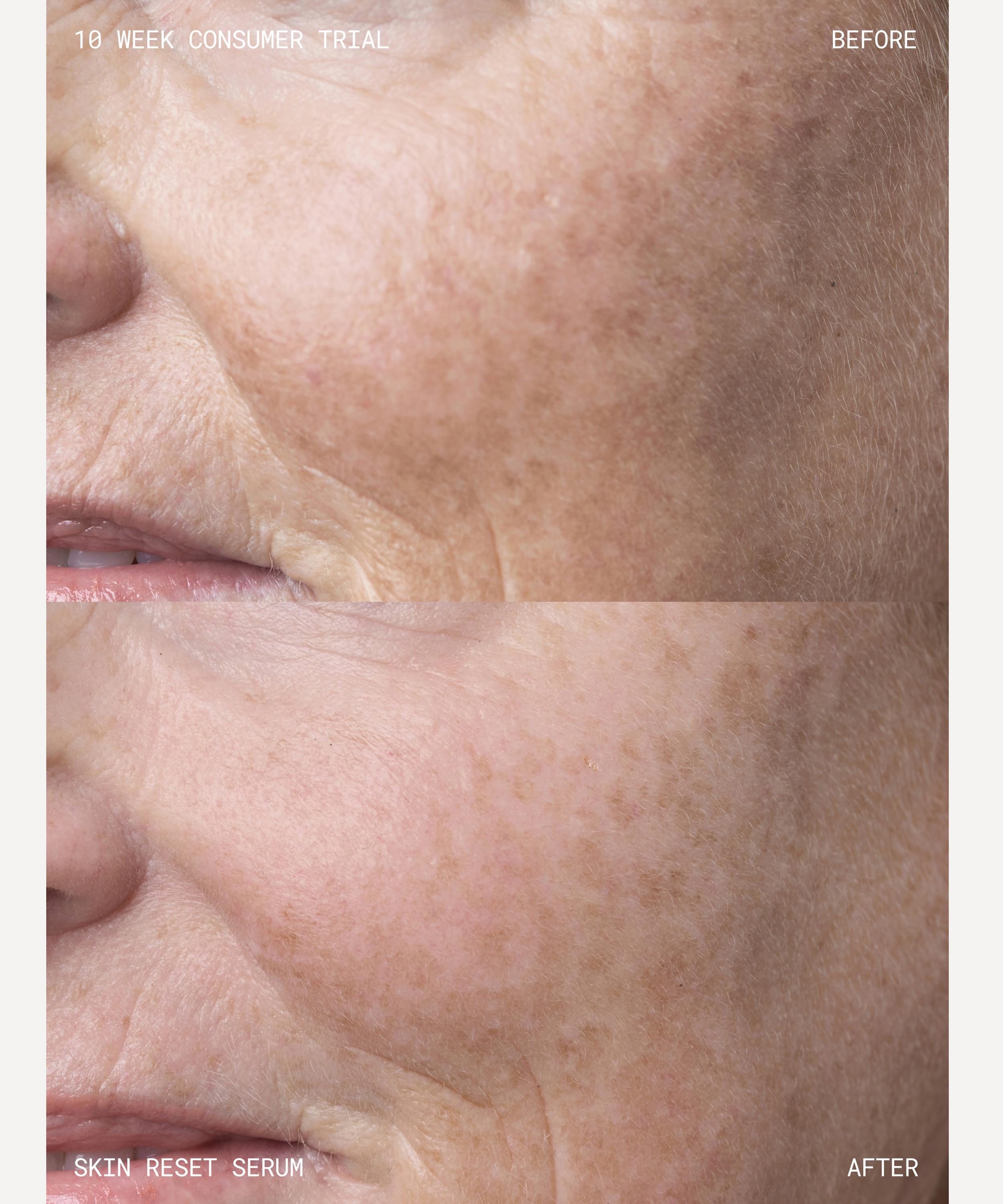 Emma Lewisham - Skin Reset Face Serum 30ml image number 7