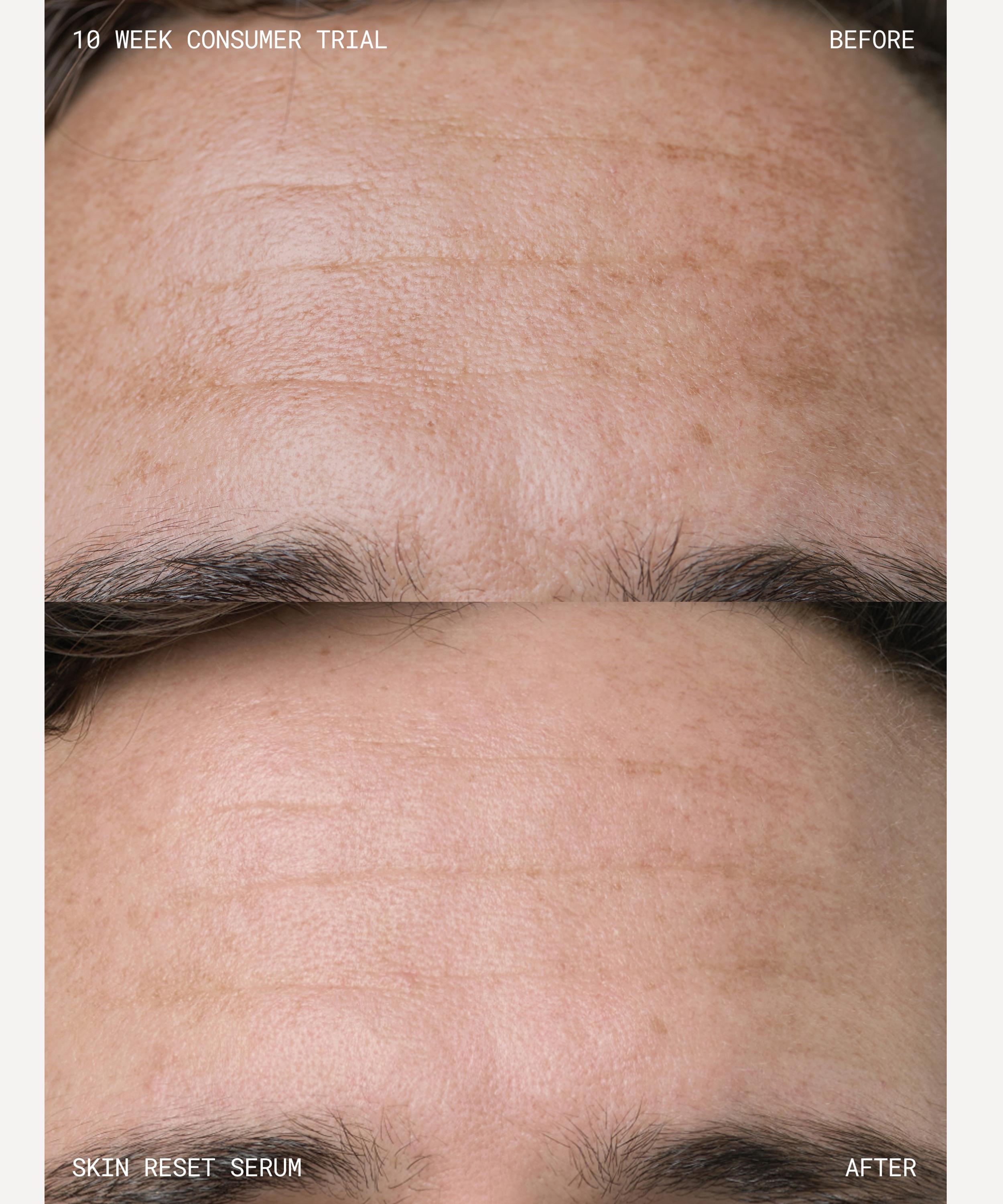 Emma Lewisham - Skin Reset Face Serum Refill 30ml image number 6
