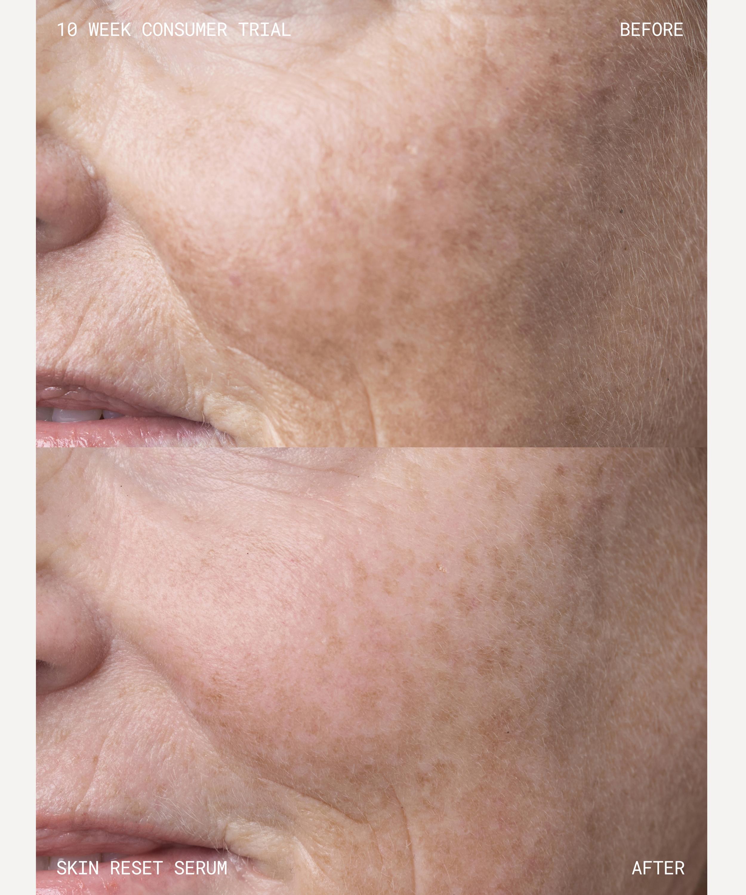 Emma Lewisham - Skin Reset Face Serum Refill 30ml image number 7