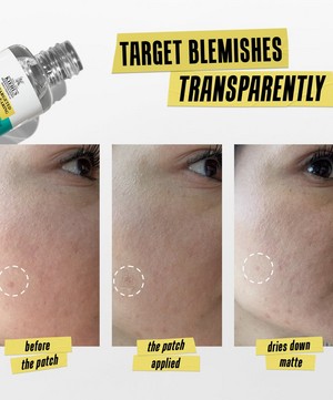 Kiehl's - Truly Targeted Blemish Control 15ml image number 3