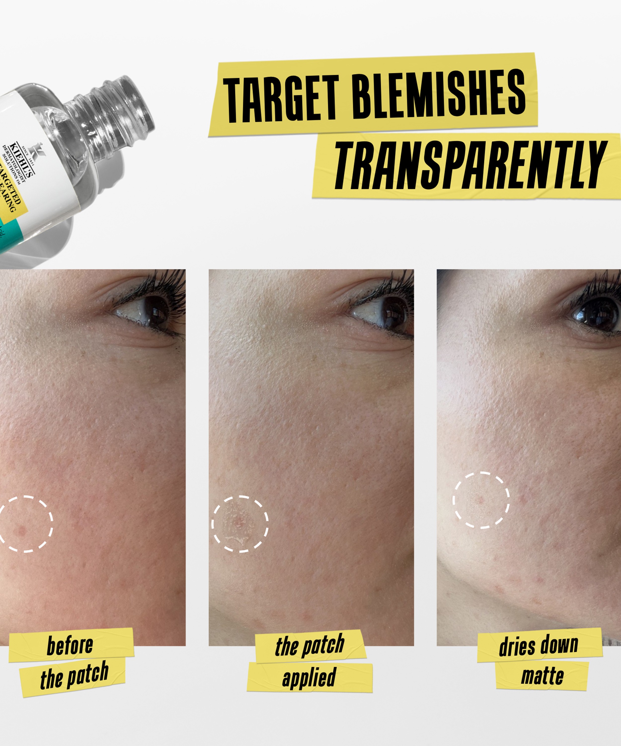 Kiehl's - Truly Targeted Blemish Control 15ml image number 3