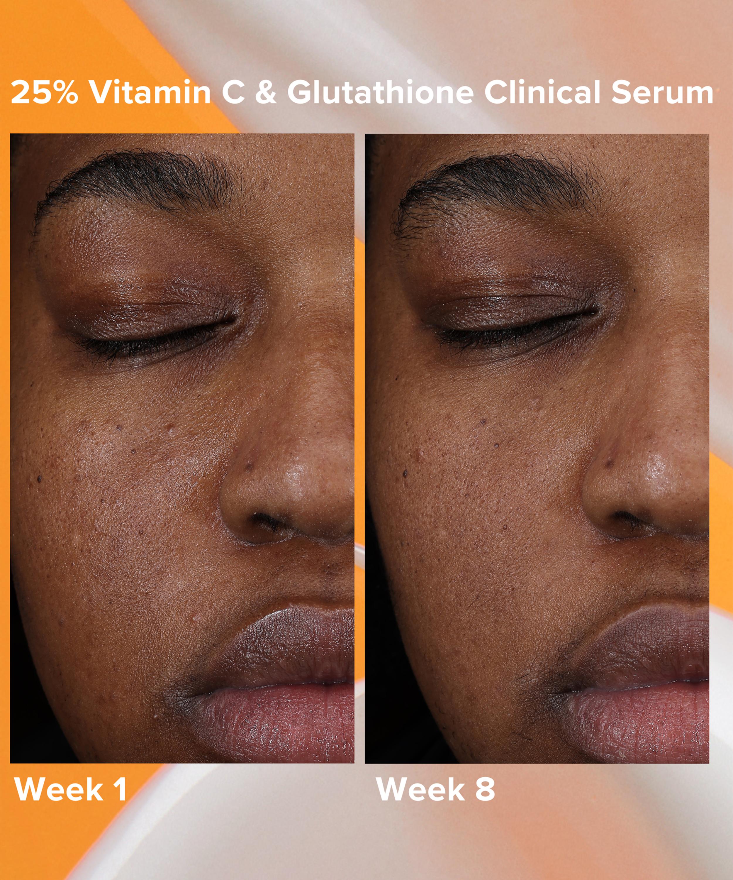 Paula's Choice - Vitamin C and Glutathione Clinical Serum 30ml image number 4