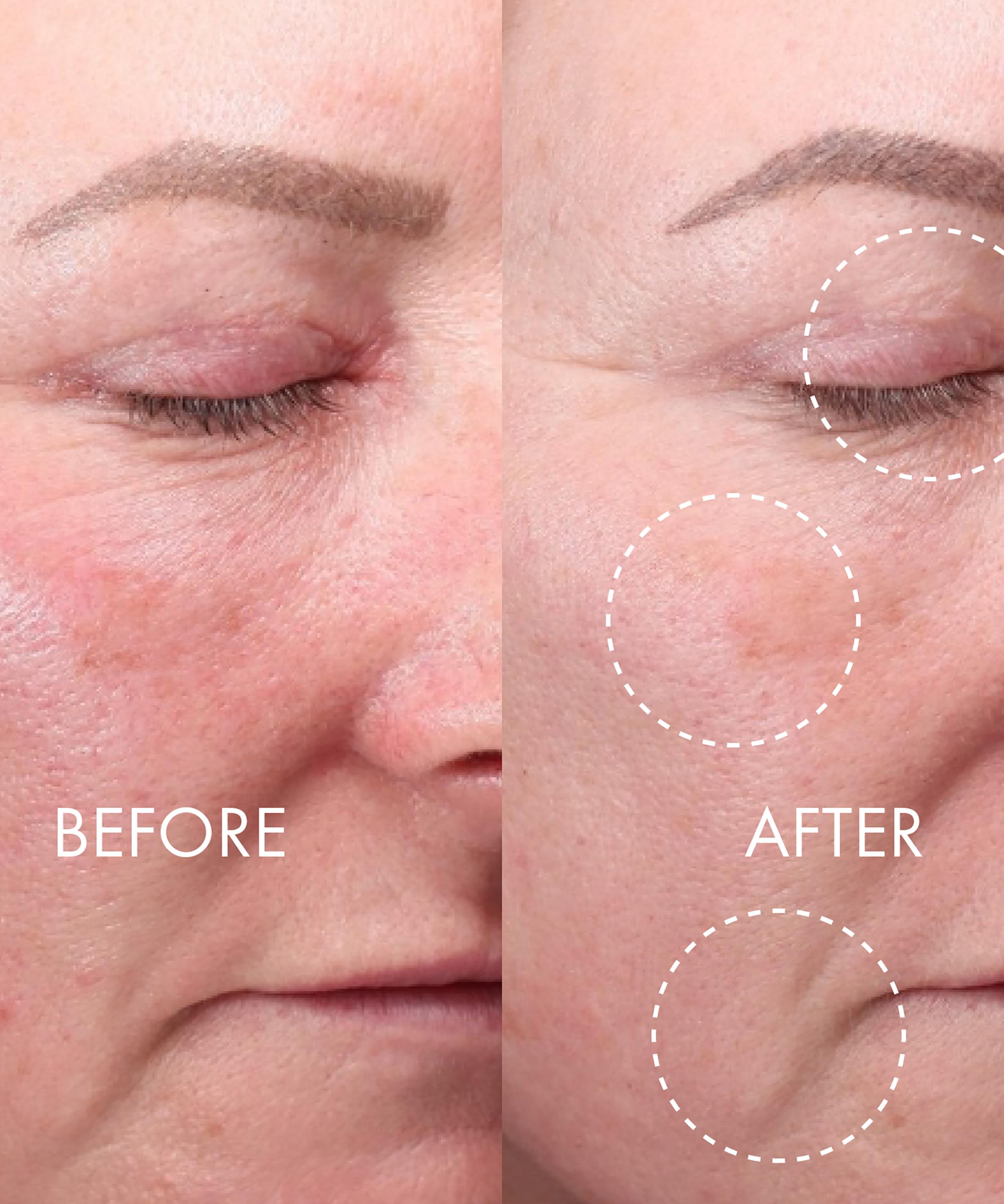 QMS Medicosmetics - Derma Expert Light Treatment LED Mask image number 2