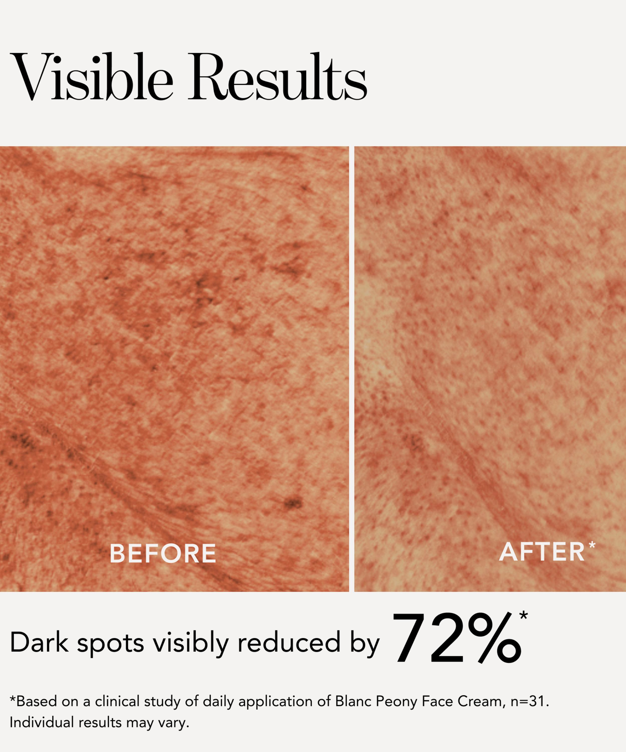 Chantecaille - Blanc Peony Face Cream Dark Spot Corrector image number 6