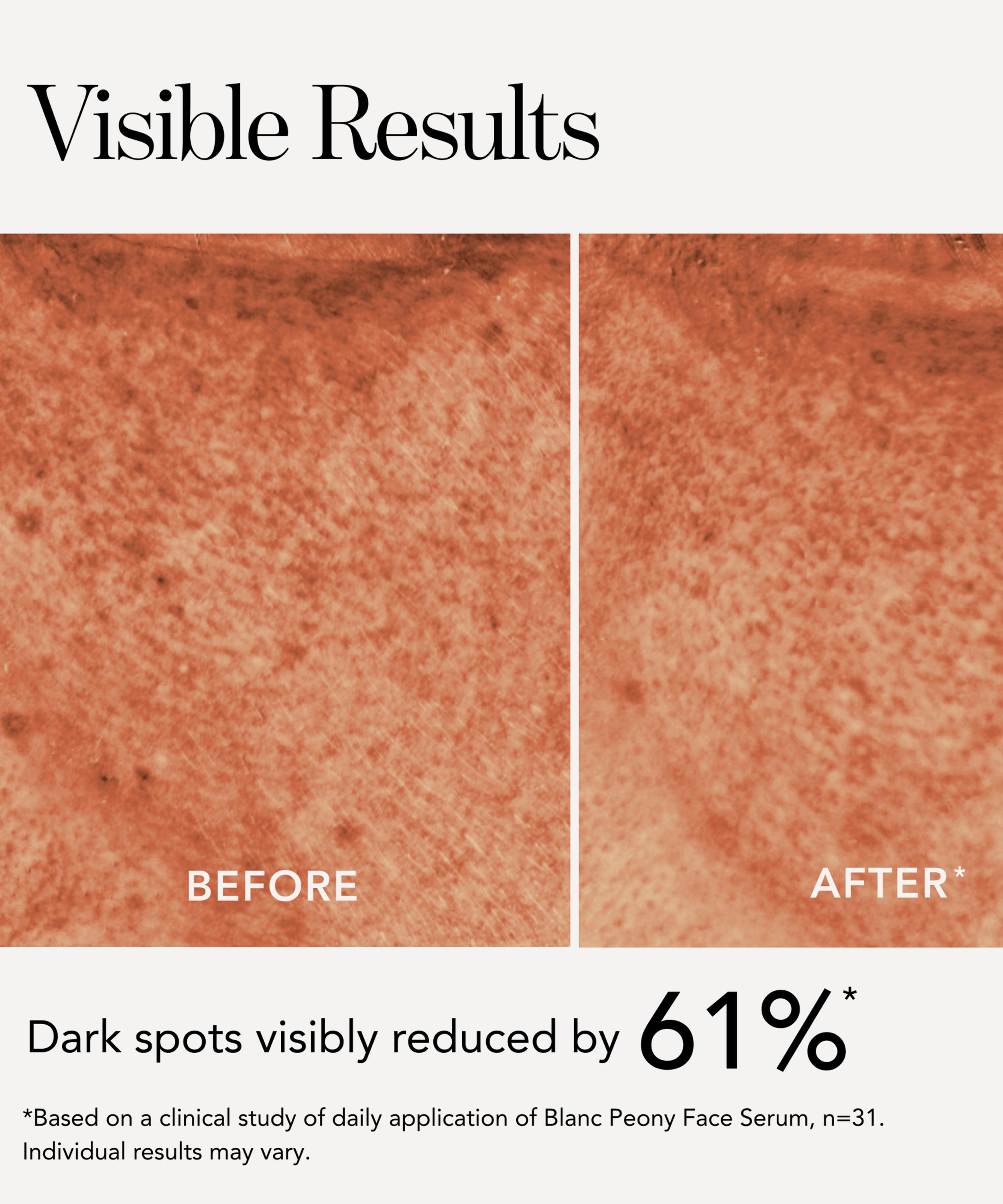 Chantecaille - Blanc Peony Face Serum Dark Spot Corrector image number 6