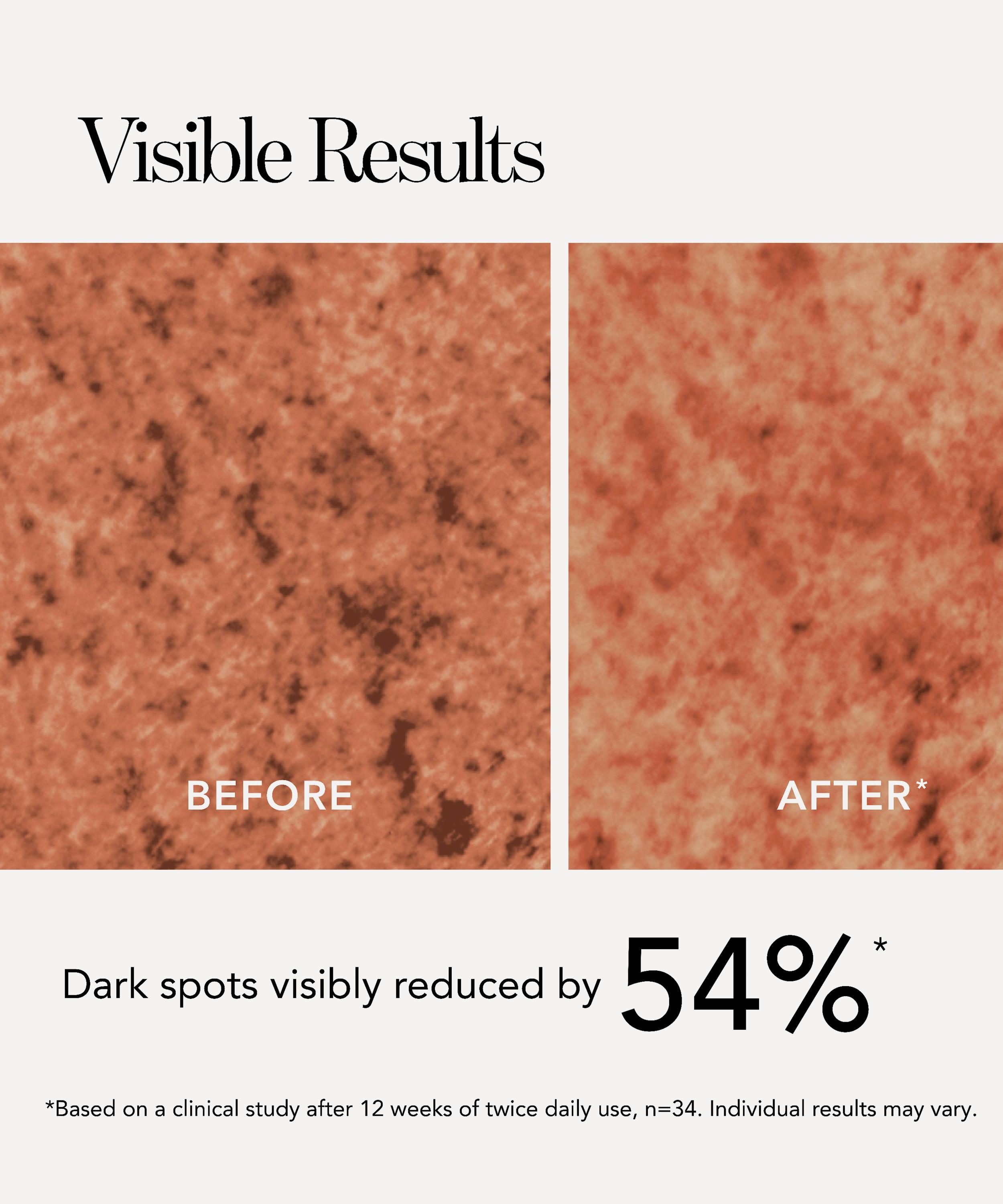 Chantecaille - Blanc Peony Eye Serum Dark Spot Corrector image number 6