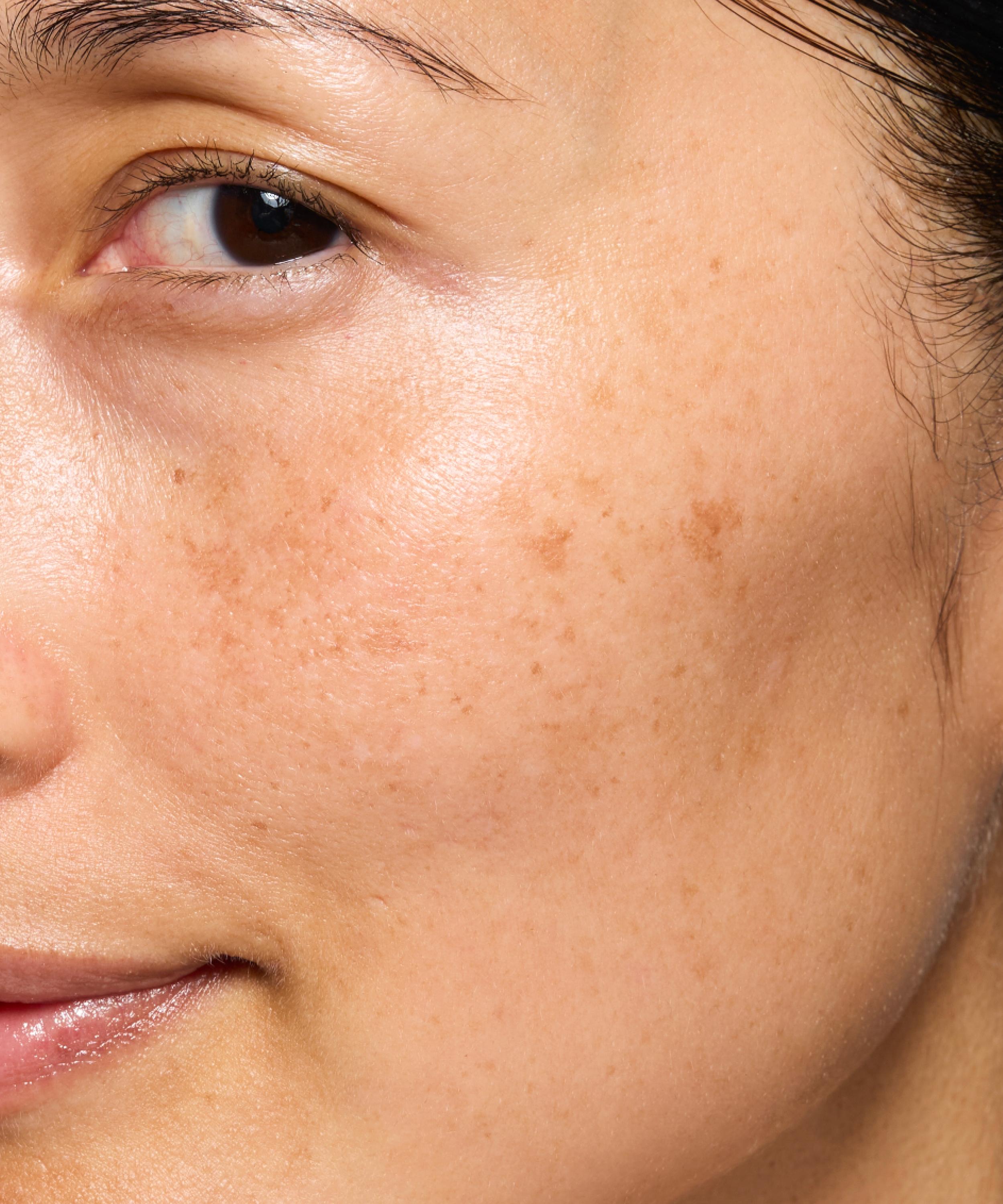 Skin Rocks - The Hyperpigmentation Serum 30ml image number 3