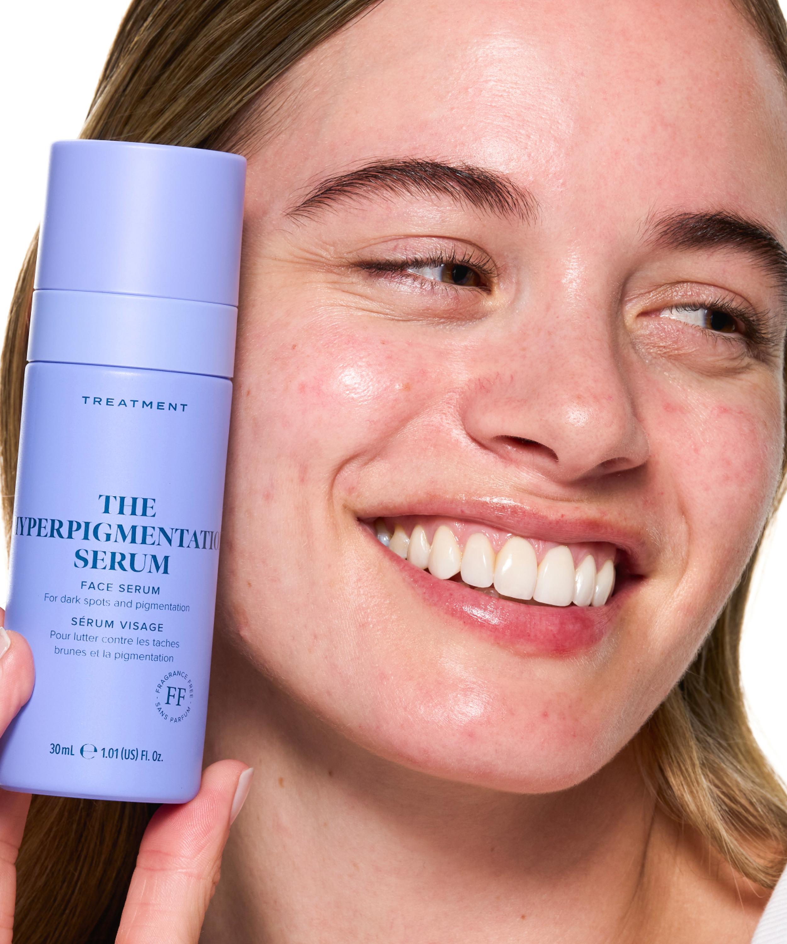 Skin Rocks - The Hyperpigmentation Serum Refill 30ml image number 3