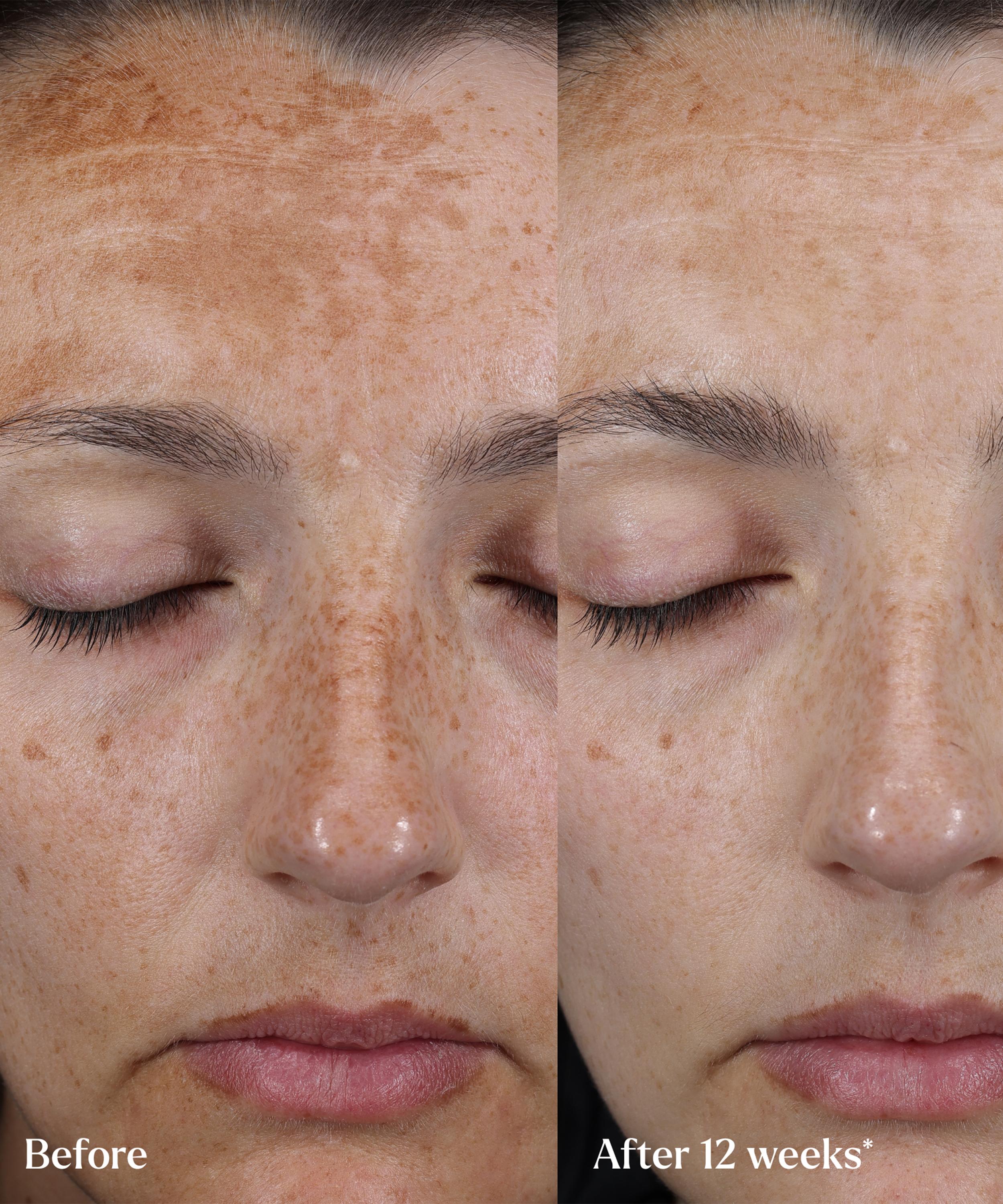 Skin Rocks - The Hyperpigmentation Serum Refill 30ml image number 5