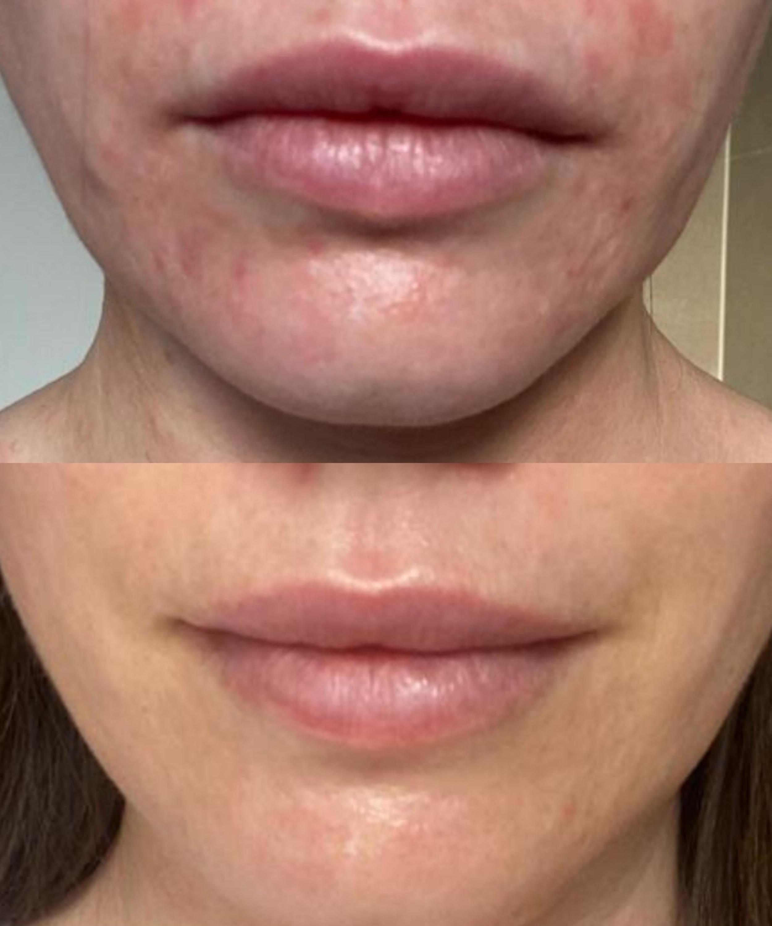 Dr. David Jack - Daily Skin Trio Discovery Set image number 4
