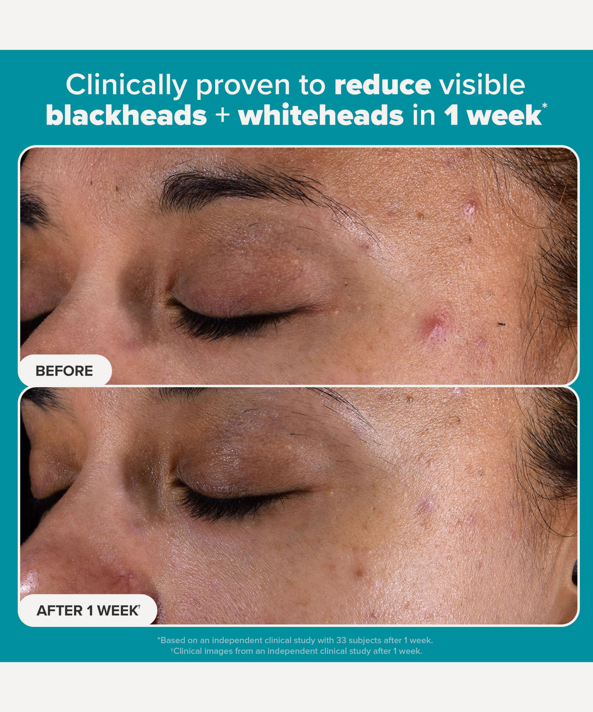 Paula's Choice - Skin Perfecting 2% BHA Exfoliating Pads image number 4
