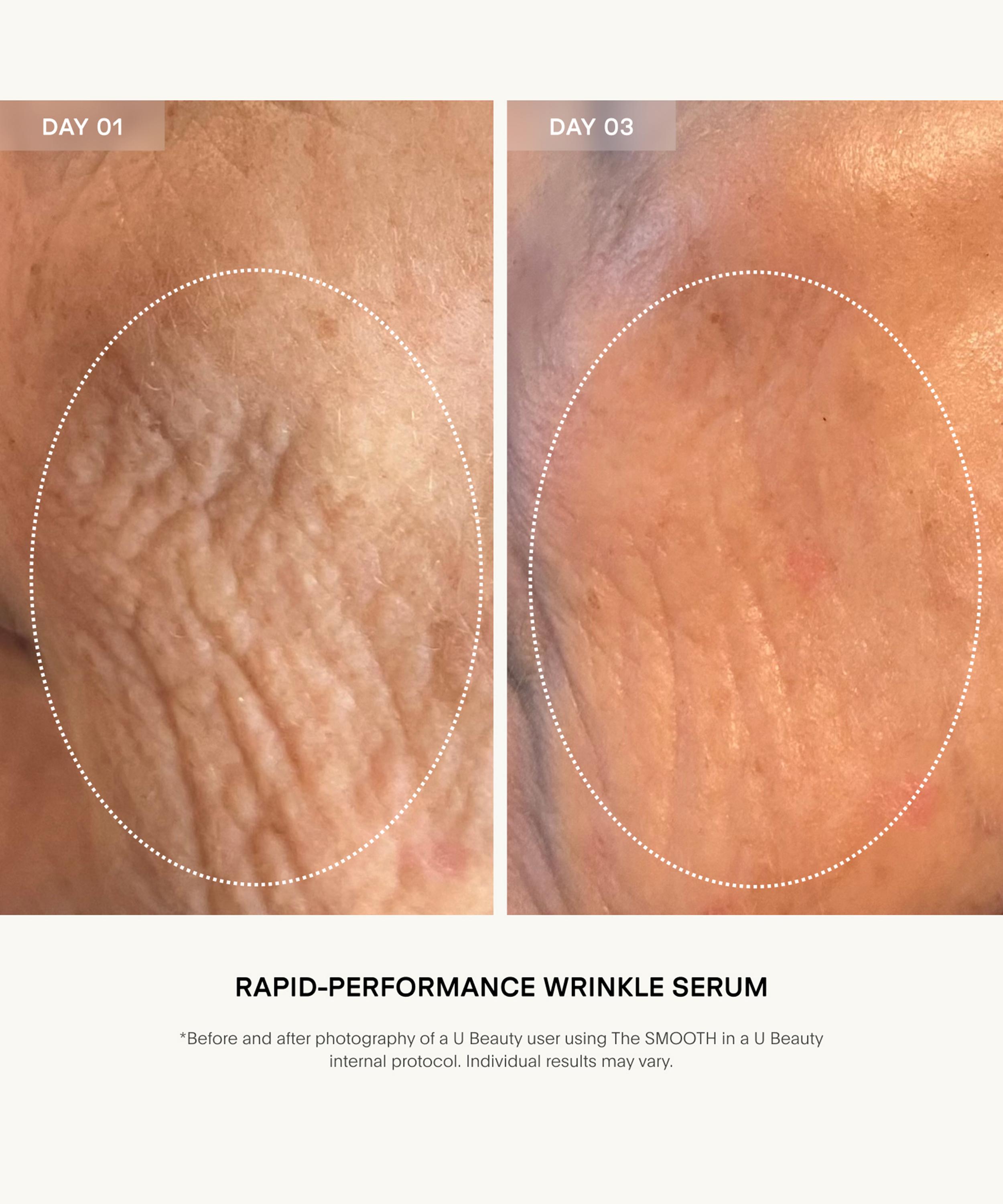 U Beauty - The SMOOTH Dynamic Wrinkle Defense Serum 30ml image number 4
