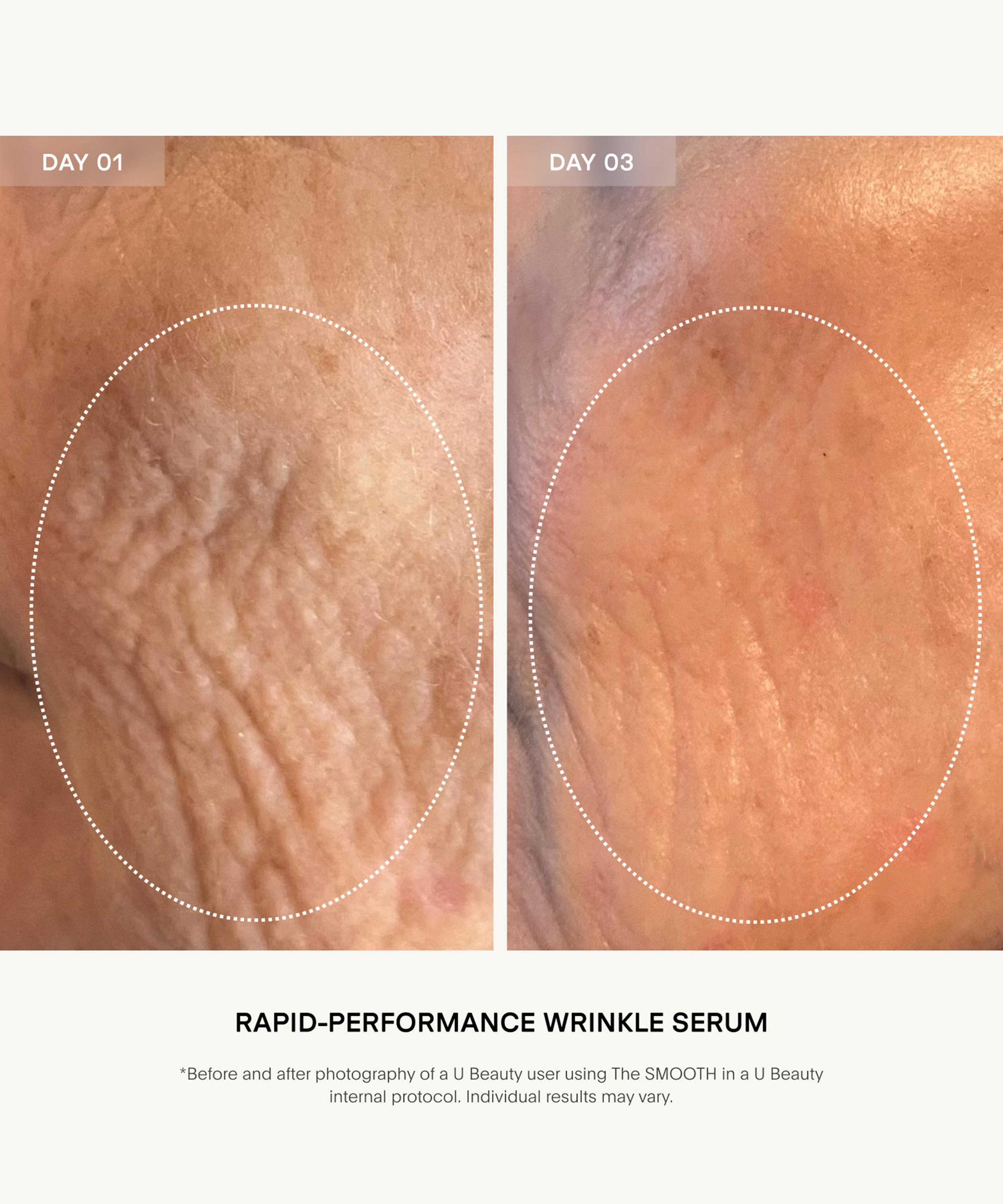 U Beauty - The SMOOTH Dynamic Wrinkle Defense Serum 15ml image number 4