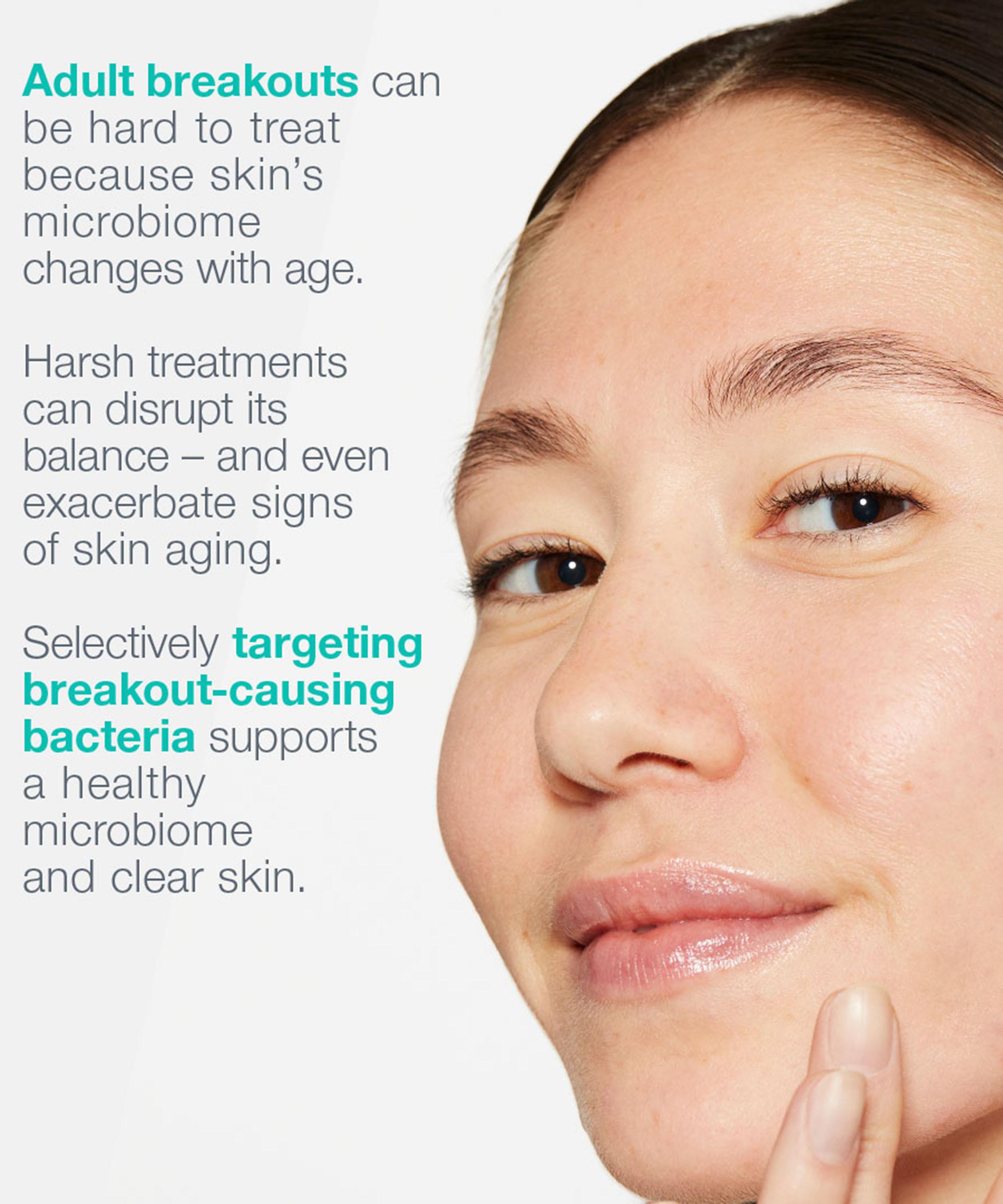 Dermalogica - Breakout Biotic Moisturiser 50ml image number 6
