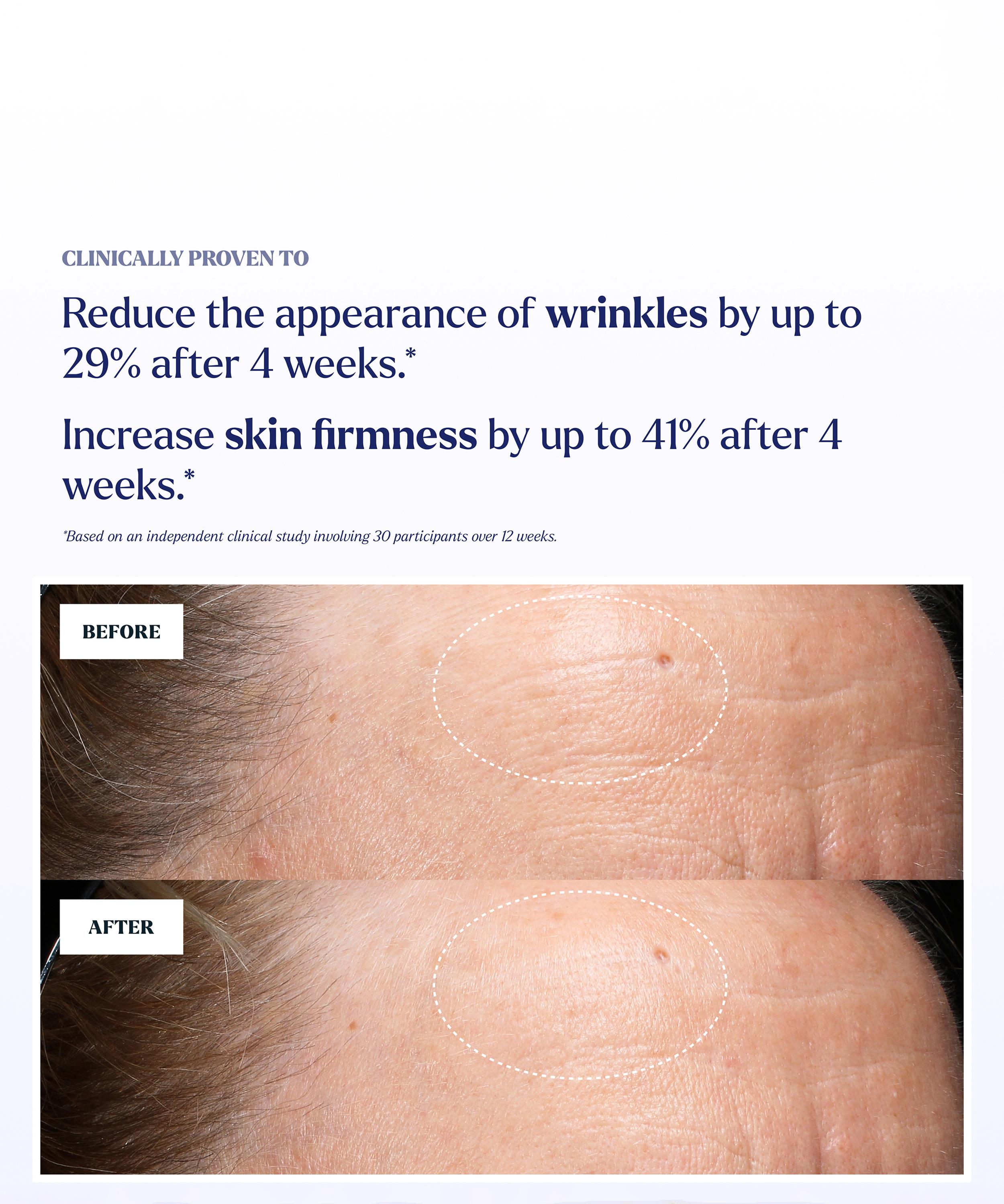 Skin Rocks - Retinoid 3 Vitamin A Face Serum 30ml image number 7