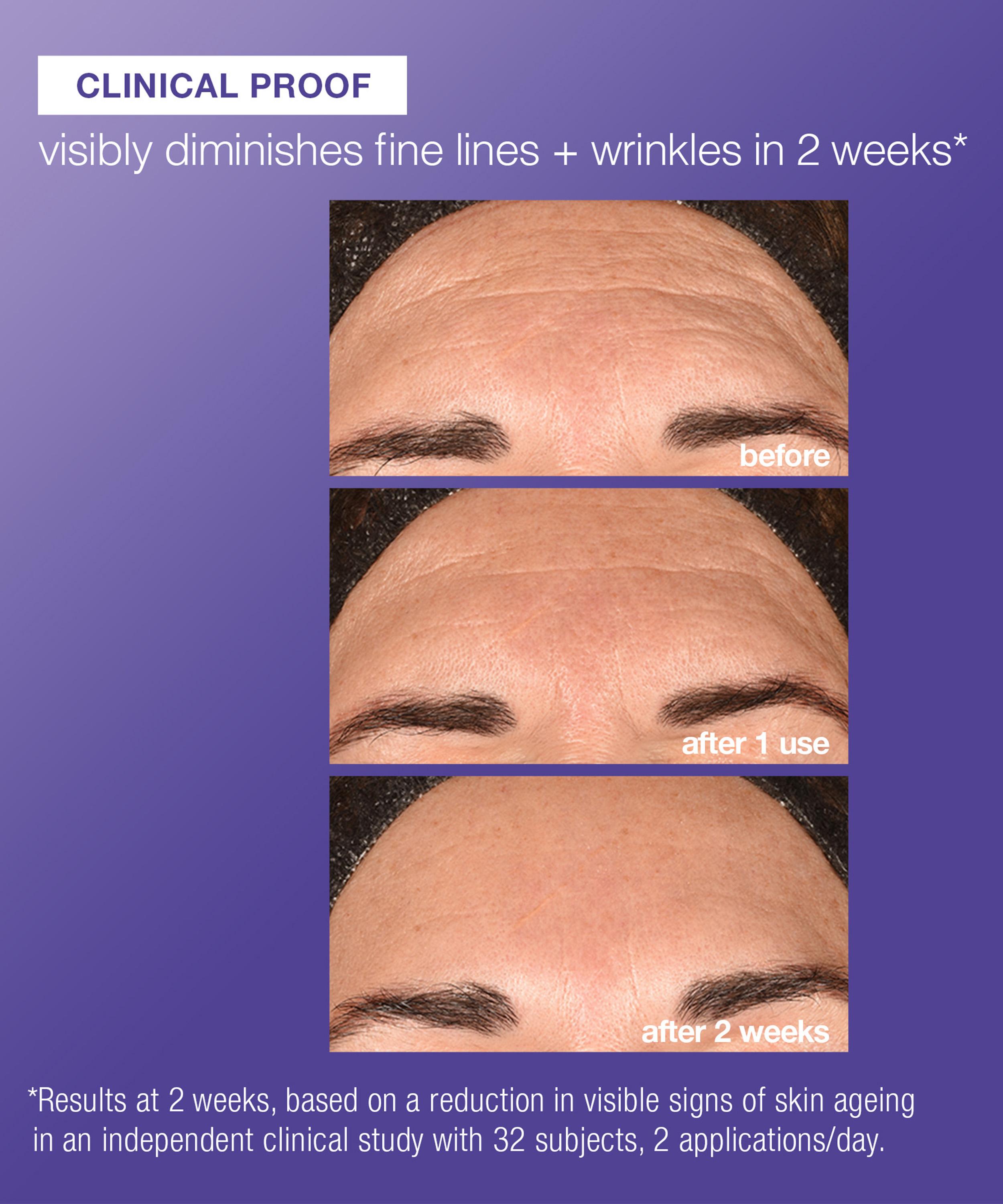 Dermalogica - Phyto Nature E&sup2; Regenerating Daily Exosome Leave-On Treatment 100ml image number 1