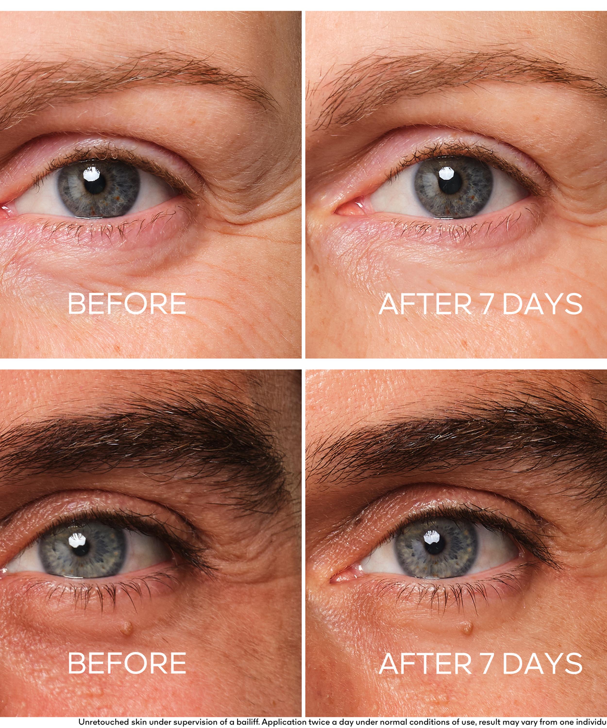 Guerlain - Abeille Royale Youth Repair Eye Care 15ml image number 2