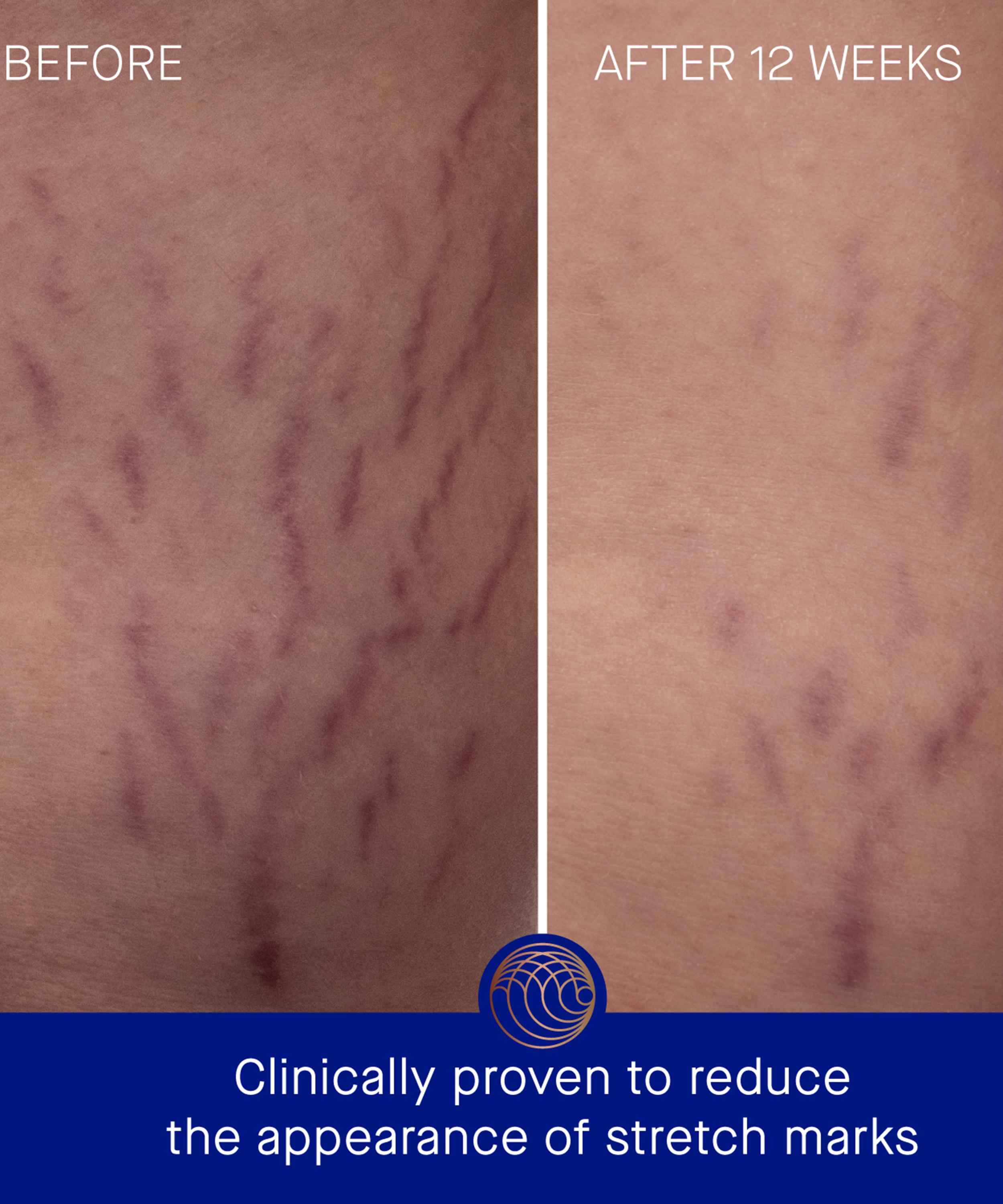 Augustinus Bader - The Geranium Rose Body Cream 200ml image number 3